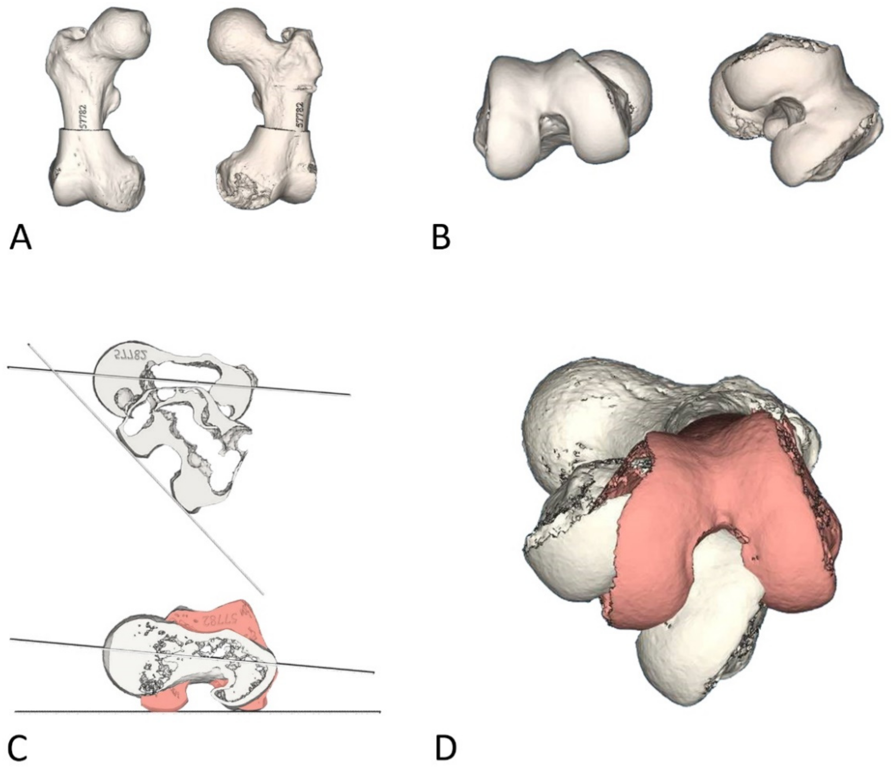 Jcm 10 03366 g001 Jcm 10 03366 g001
