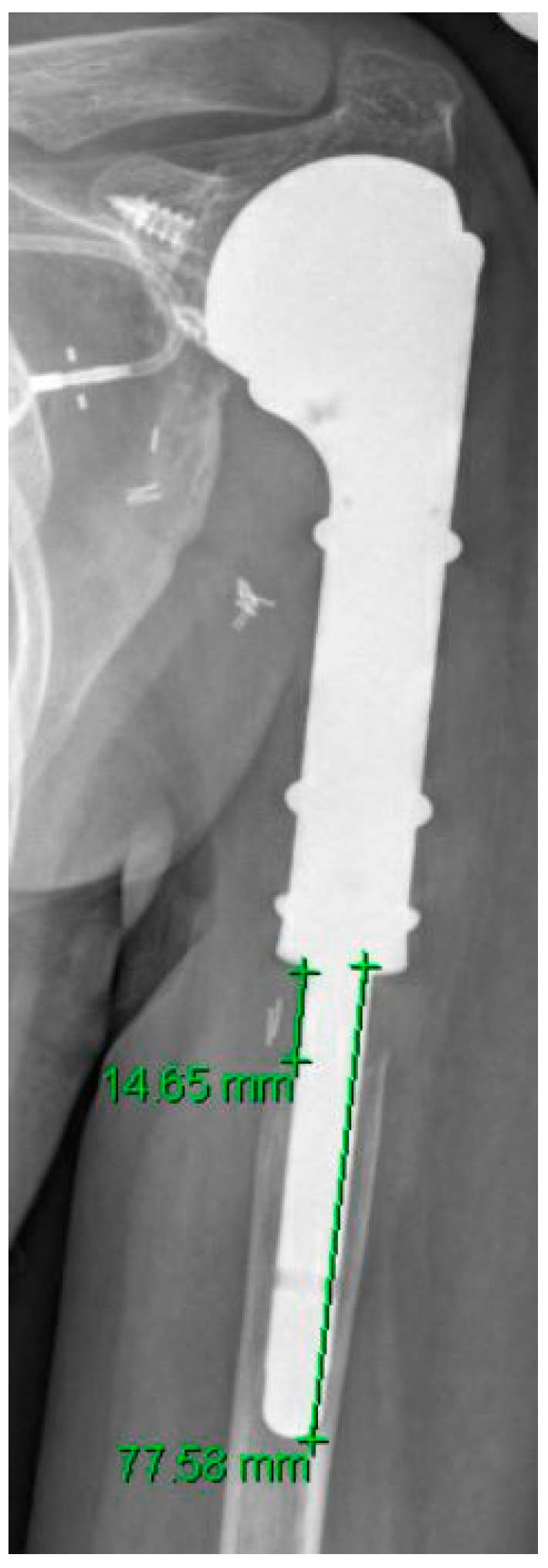 Jcm 10 03424 g002 550