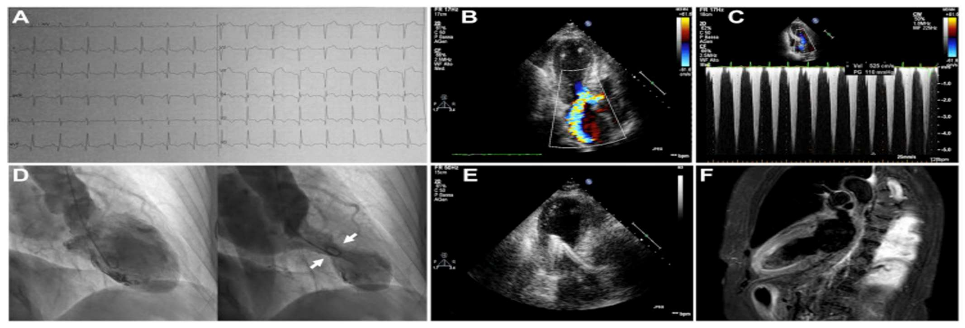 Jcm 10 03440 g005 550