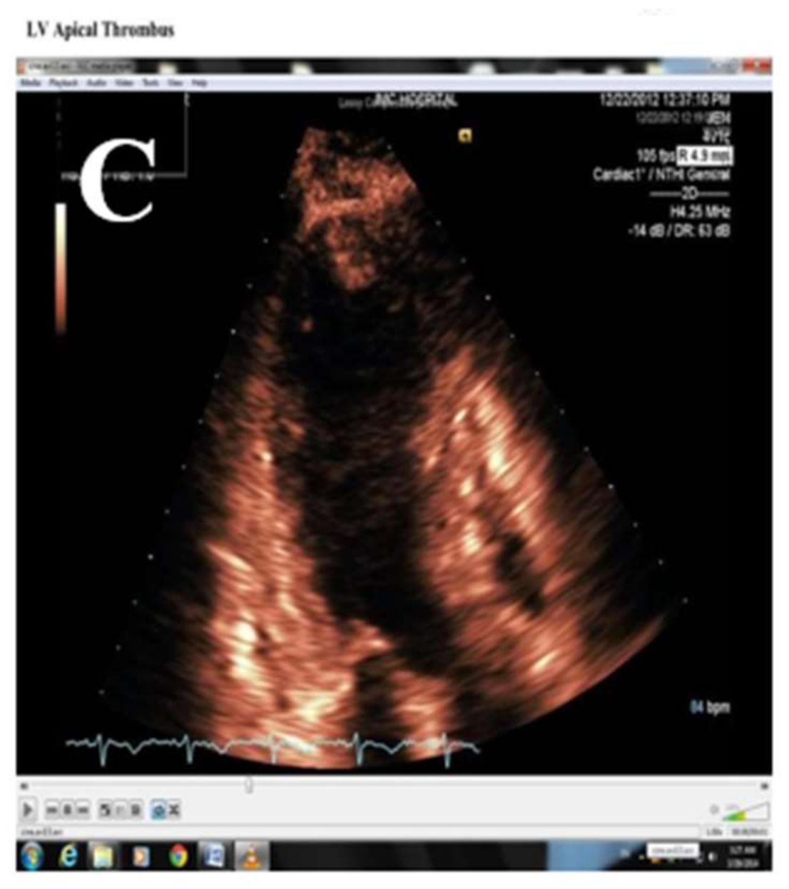 Jcm 10 03440 g006b 550