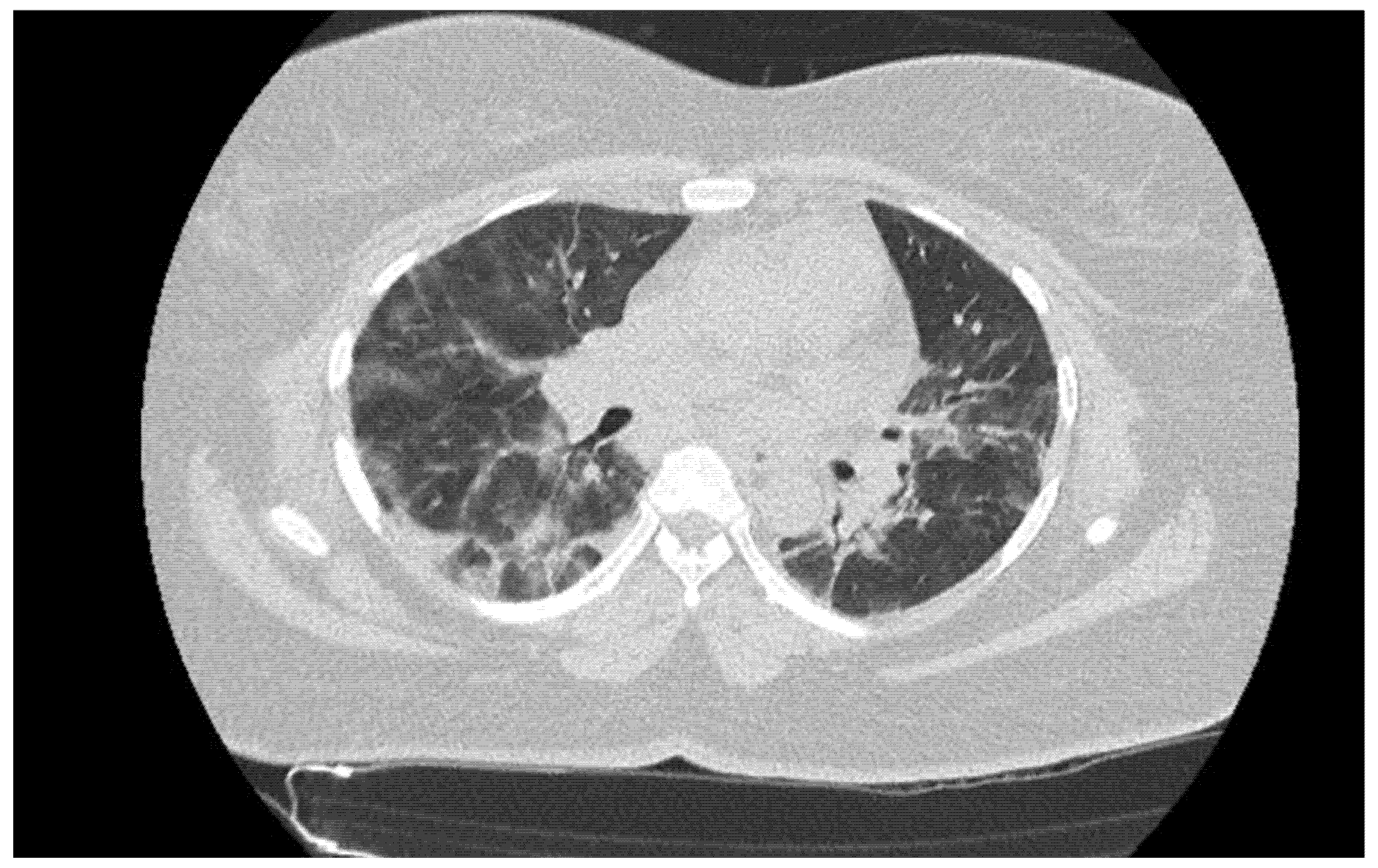 Jcm 10 03455 g002 550