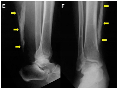 Jcm 10 03480 i003 Jcm 10 03480 i003