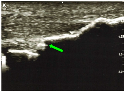 Jcm 10 03480 i005 Jcm 10 03480 i005