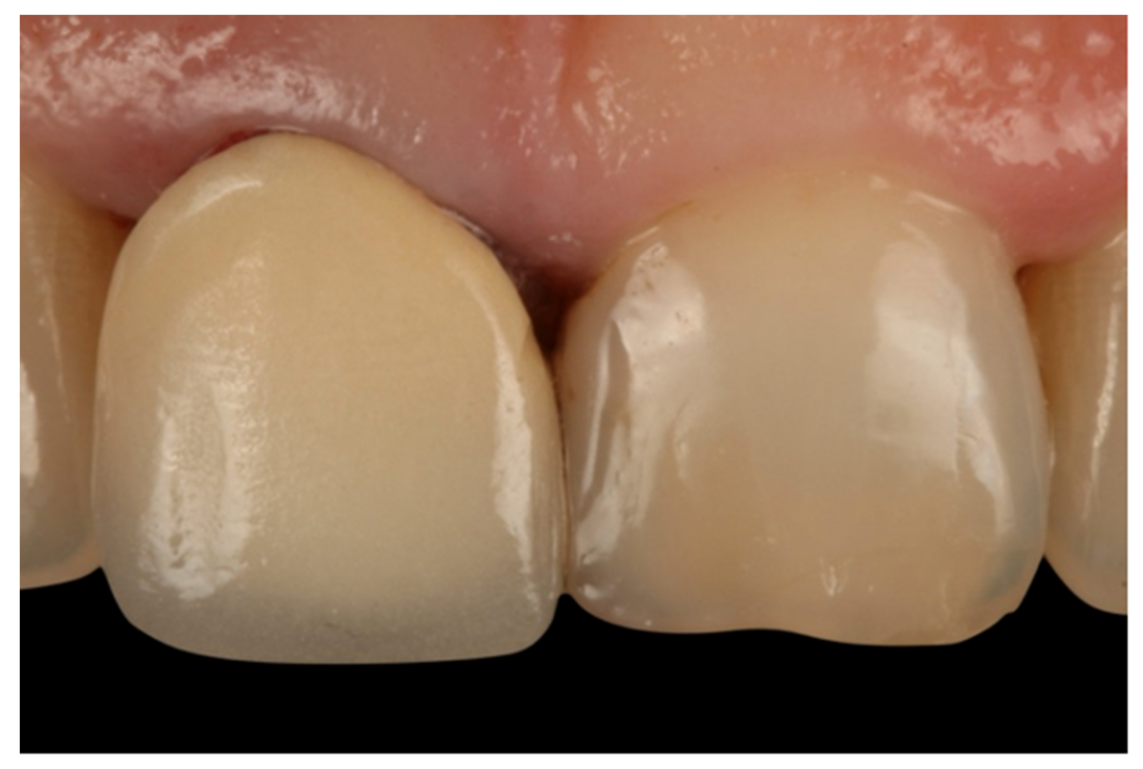 Jcm 10 03482 g001 Jcm 10 03482 g001