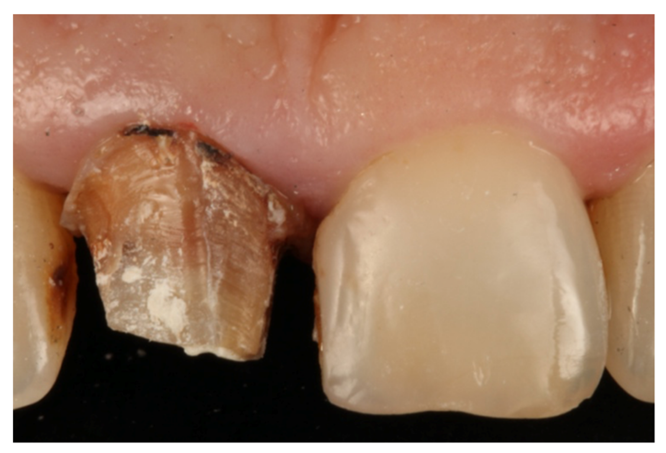 Jcm 10 03482 g002 Jcm 10 03482 g002