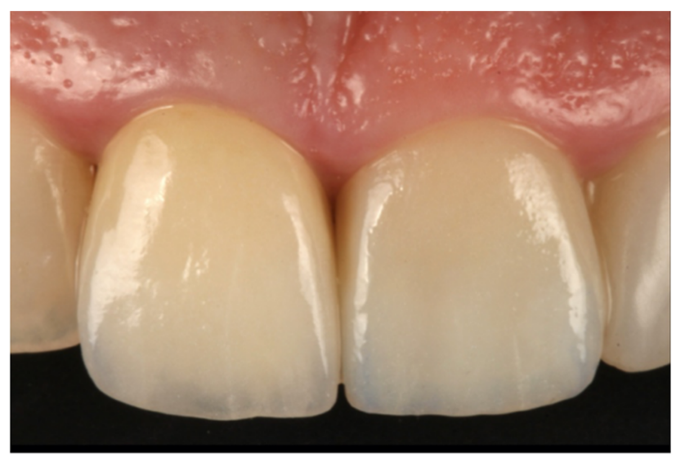 Jcm 10 03482 g006 Jcm 10 03482 g006