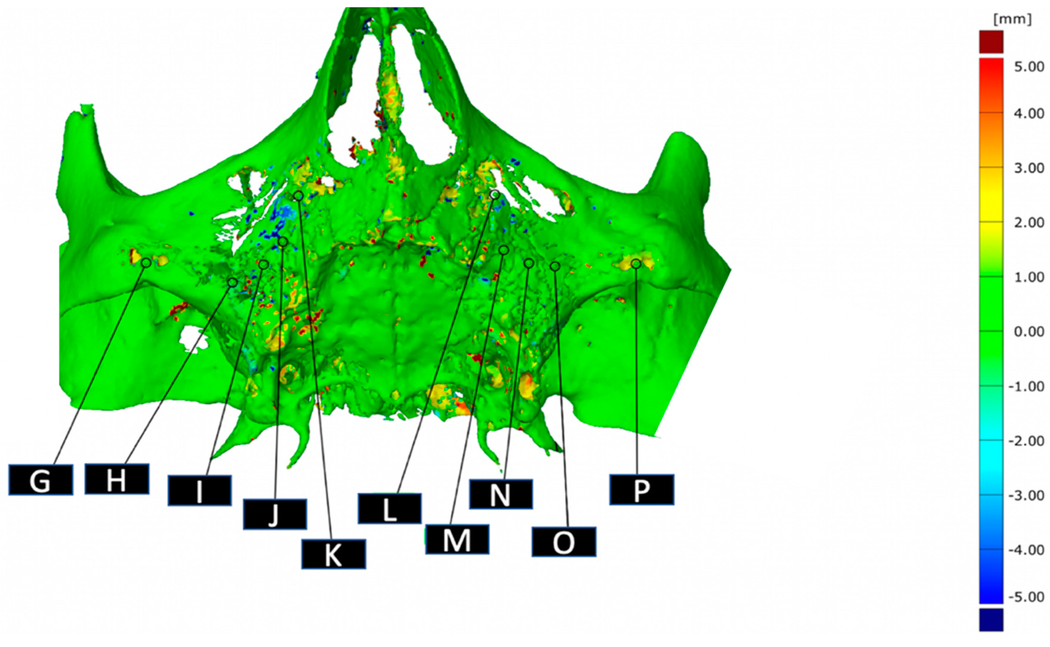 Jcm 10 03542 g003 Jcm 10 03542 g003