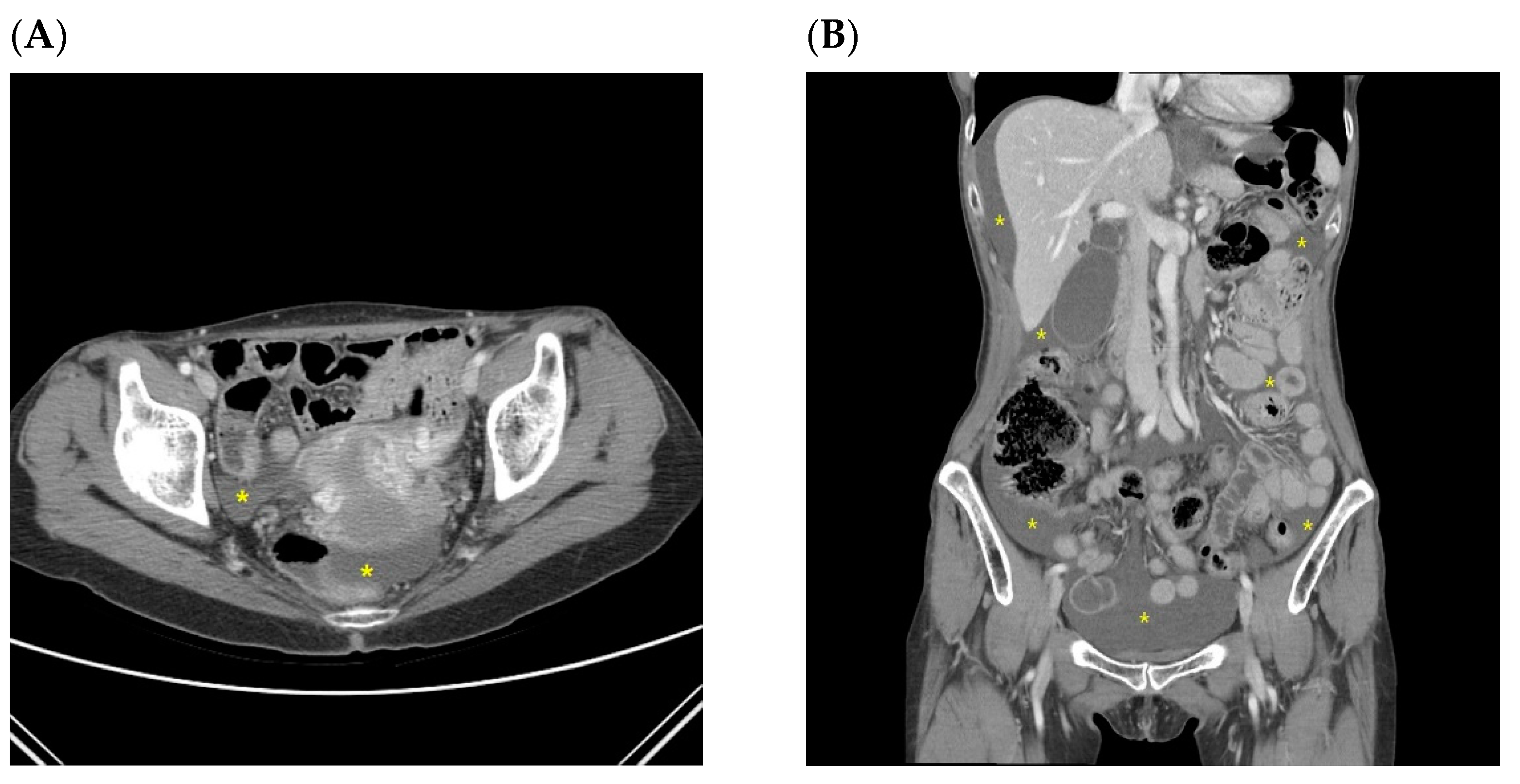 Jcm 10 03557 g003 Jcm 10 03557 g003