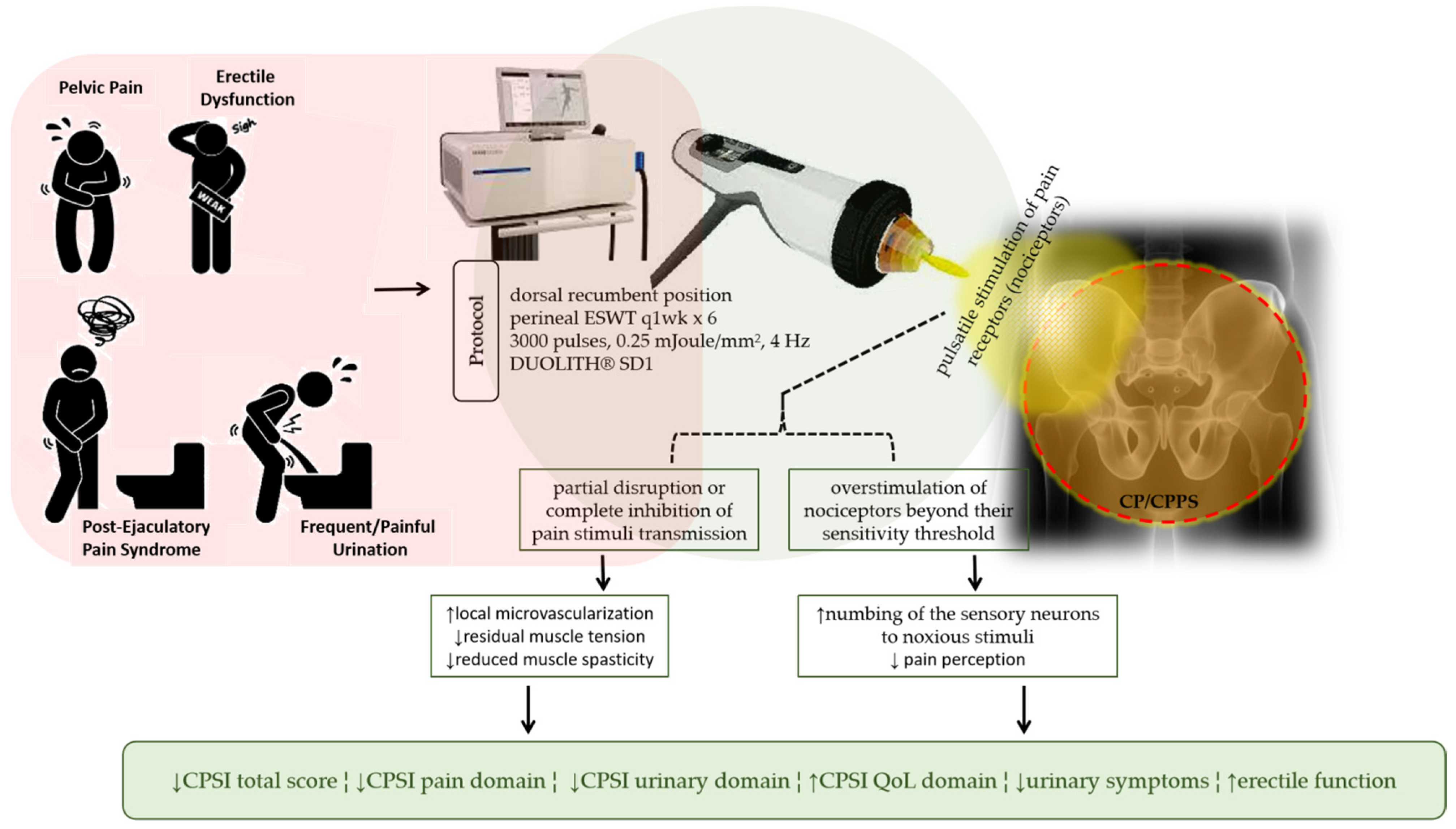 récidive cancer prostate