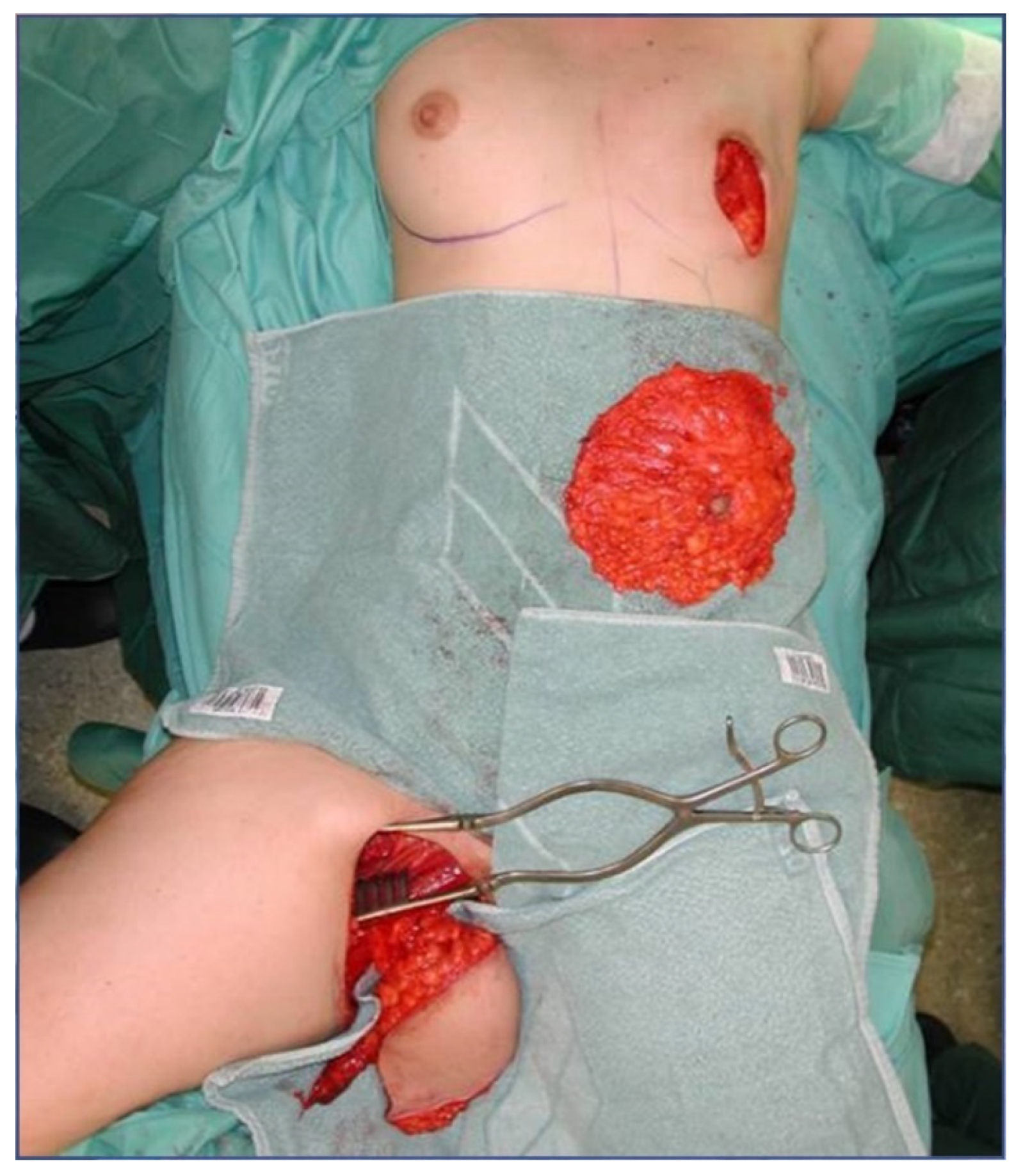 Jcm 10 03629 g002 550