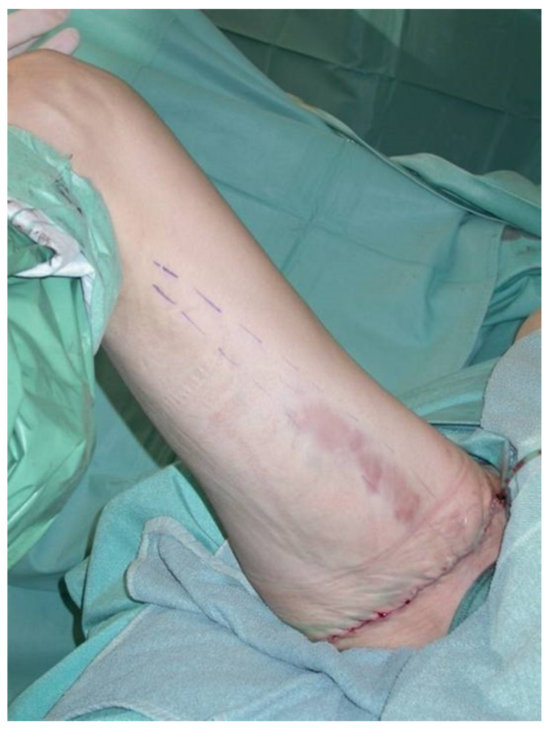 Jcm 10 03629 g004 550