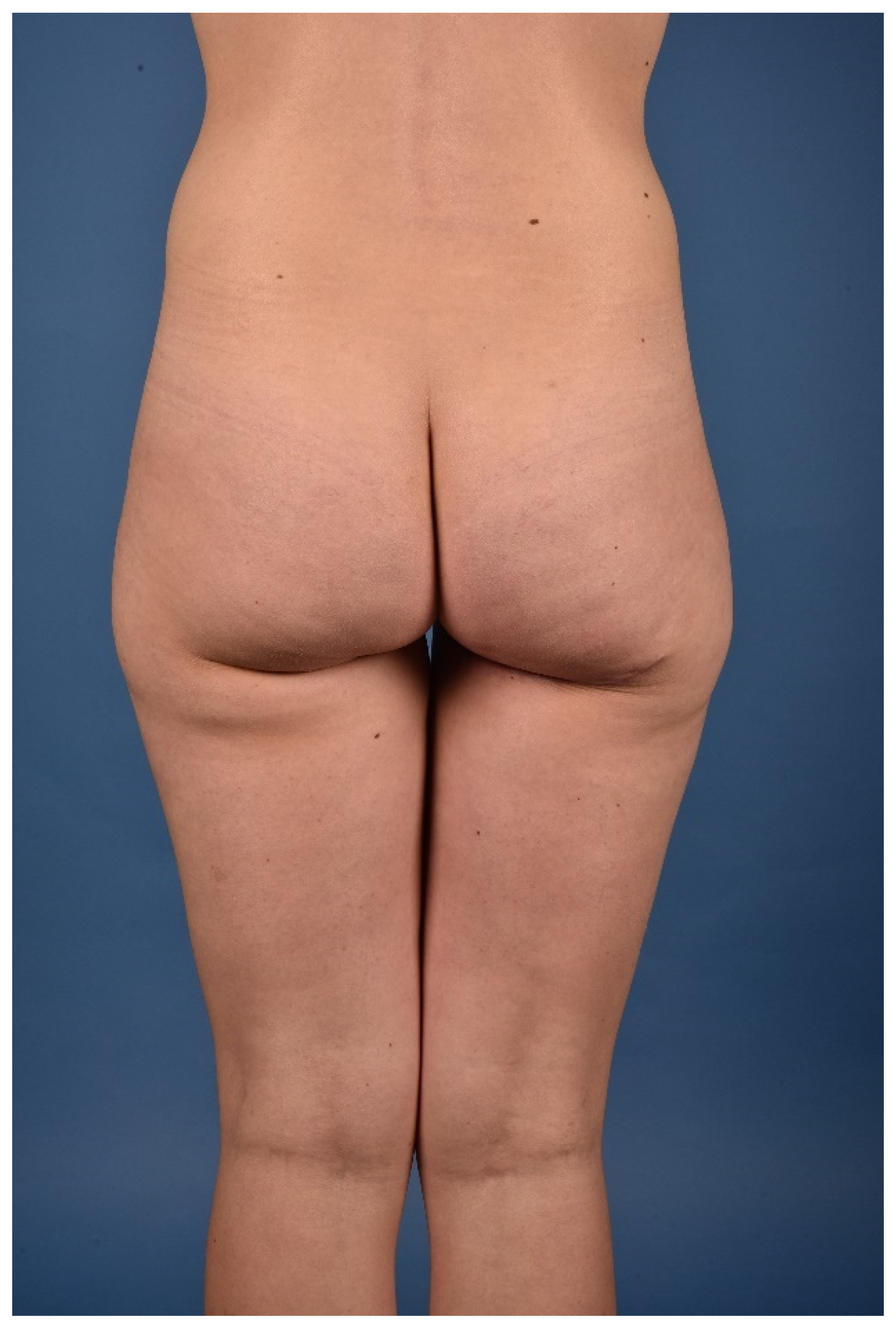 Jcm 10 03629 g007 550