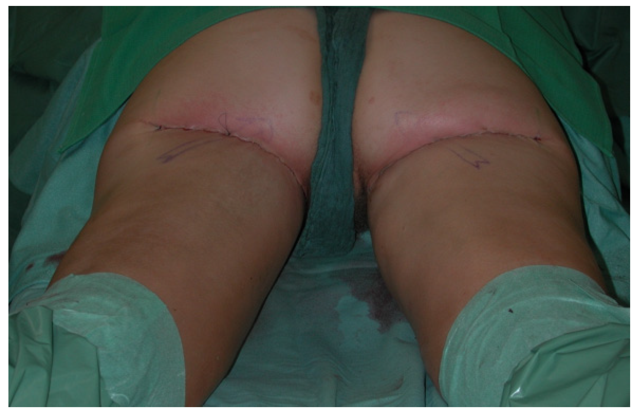 Jcm 10 03629 g014 550