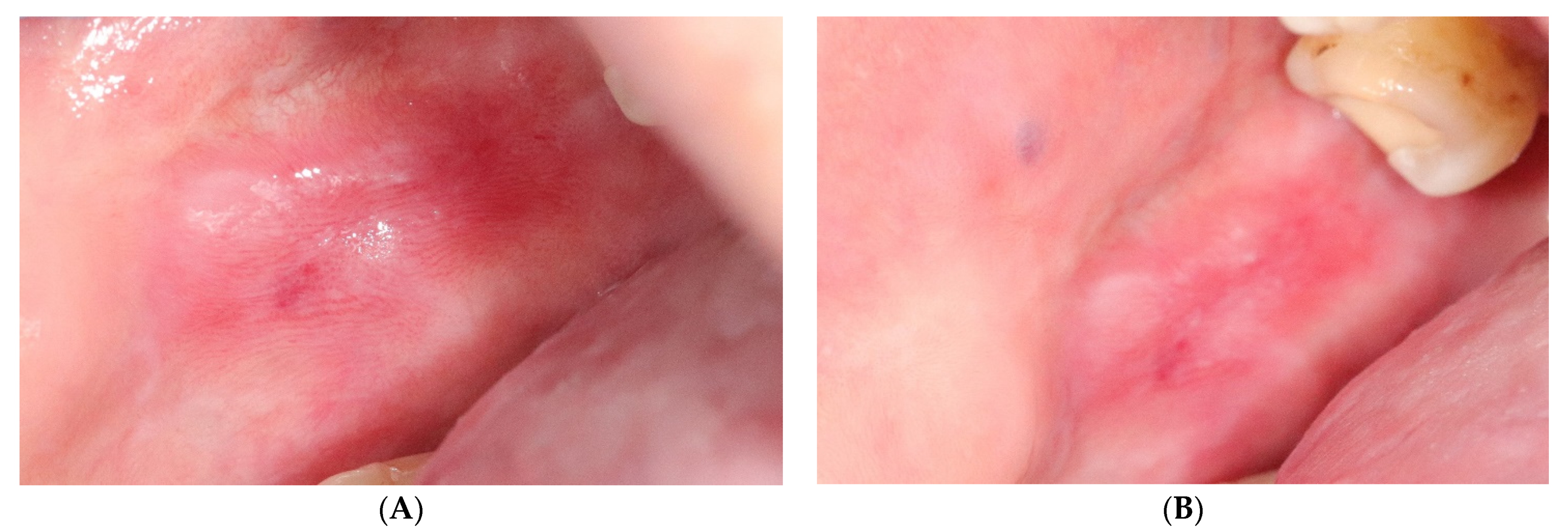 Jcm 10 03673 g004 550