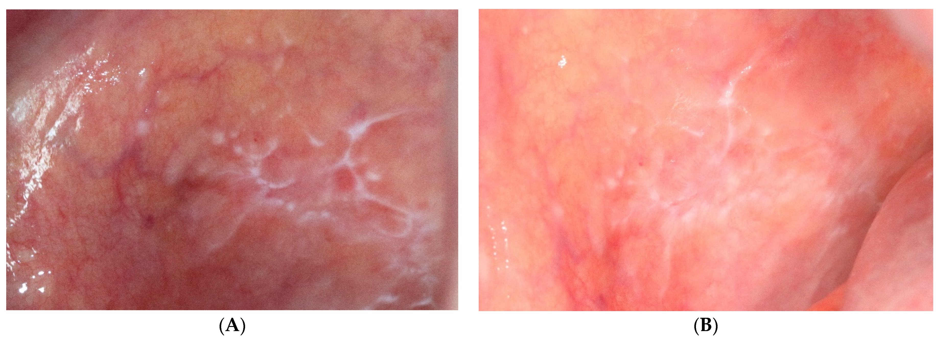 Jcm 10 03673 g005 550