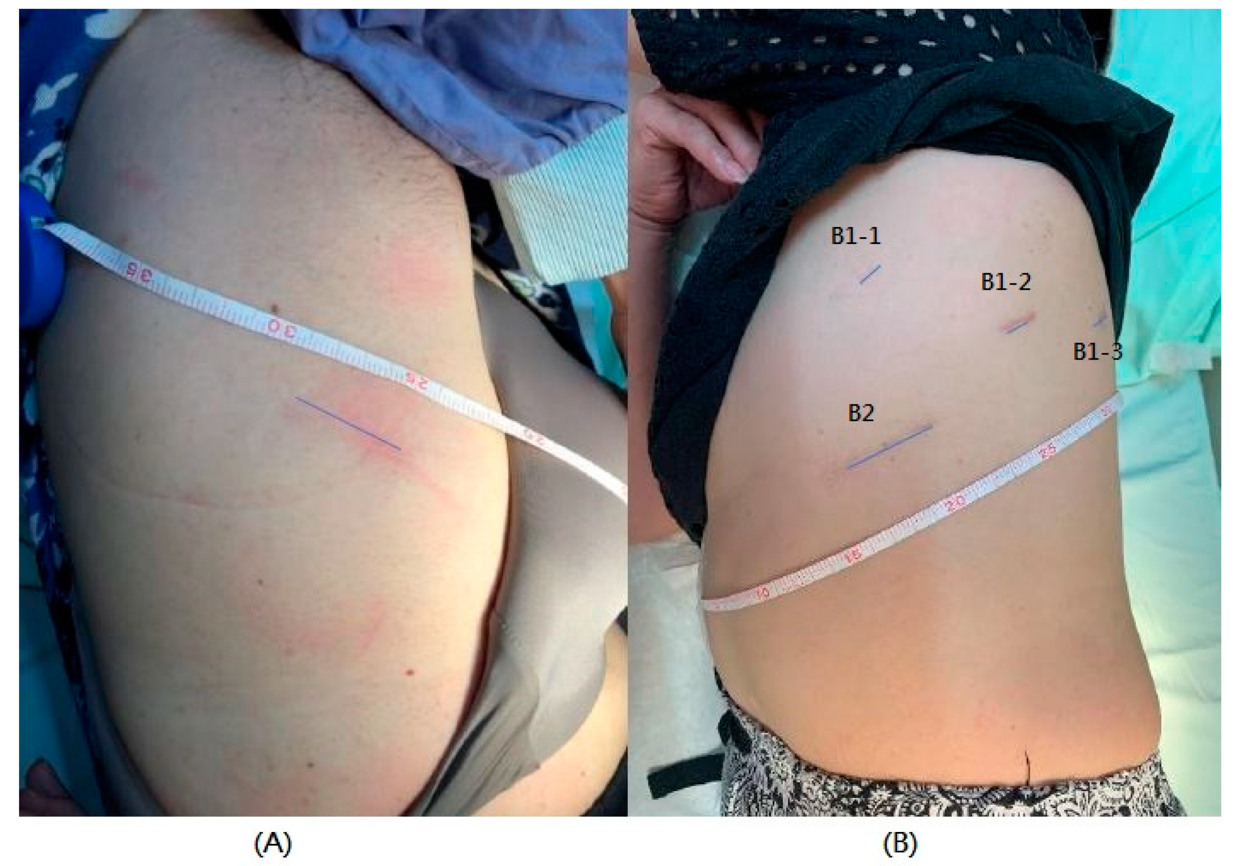 Jcm 10 03679 g001 Jcm 10 03679 g001