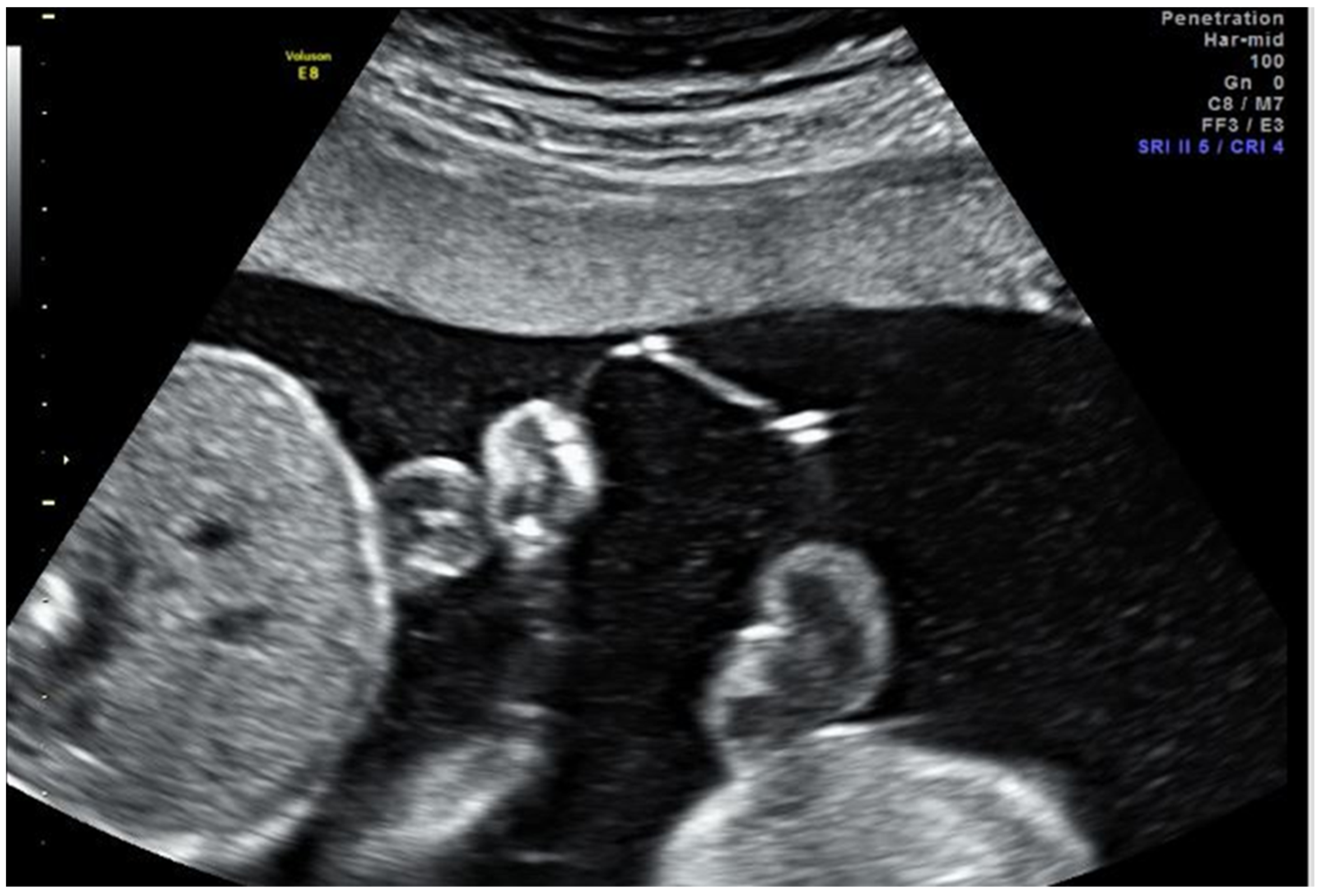 Jcm 10 03693 g001 550