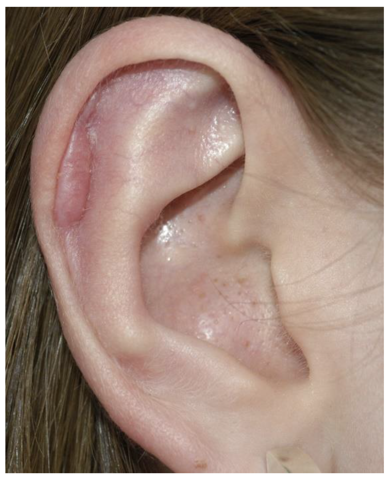 Jcm 10 03713 g004 550