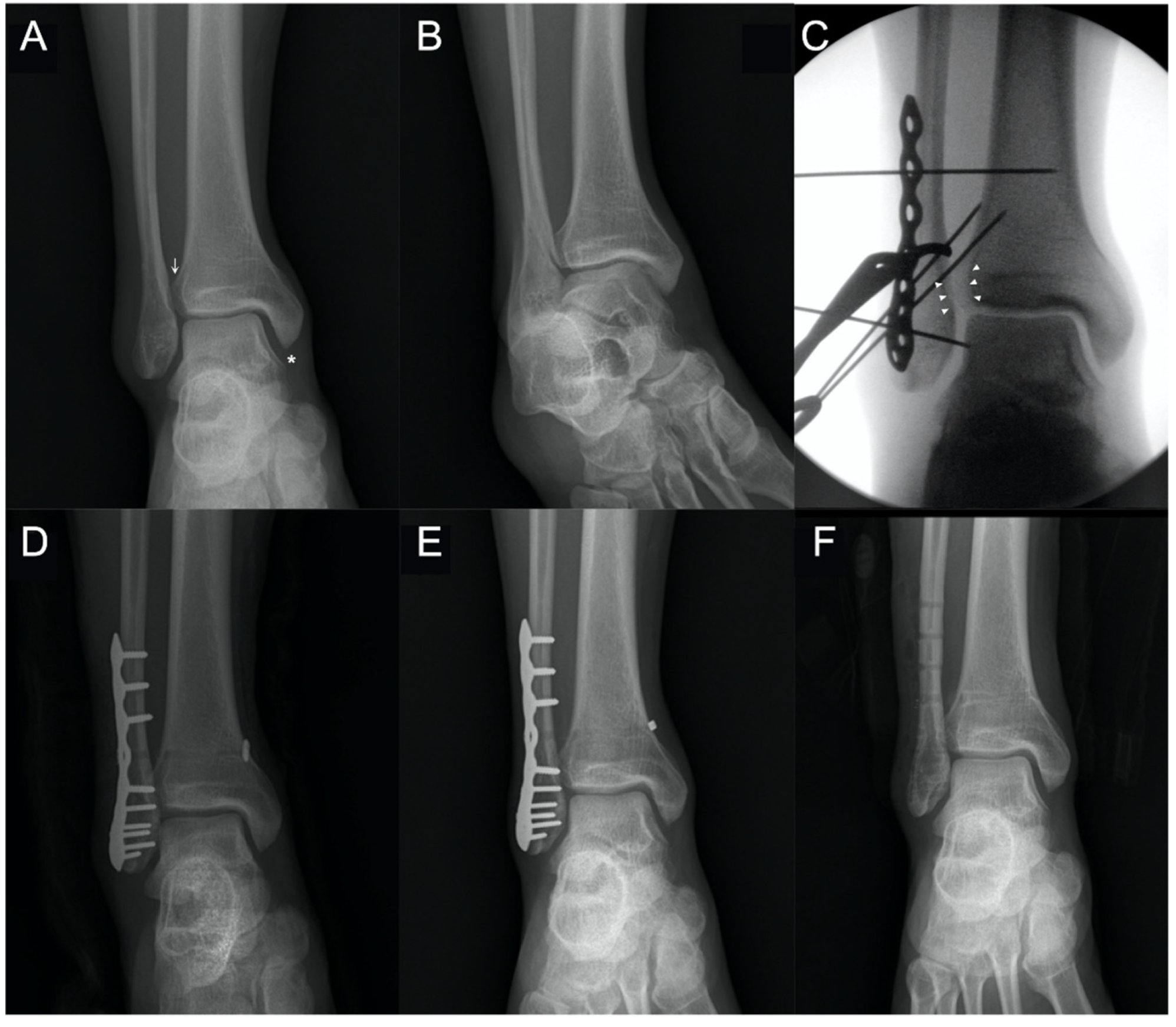 Jcm 10 03726 g002 550