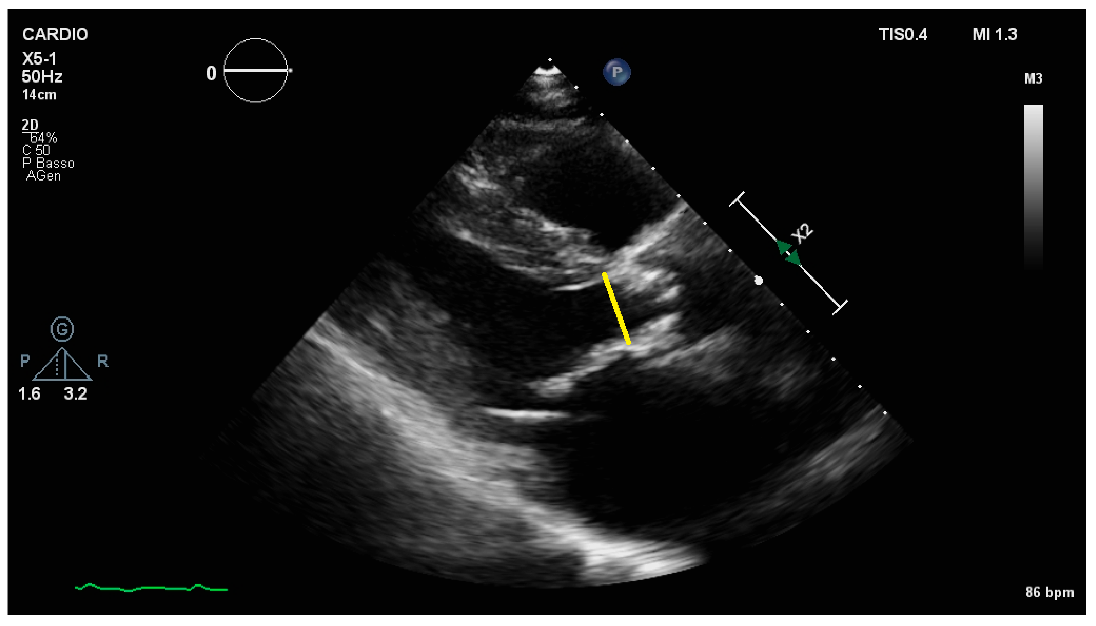 Jcm 10 03745 g002 Jcm 10 03745 g002