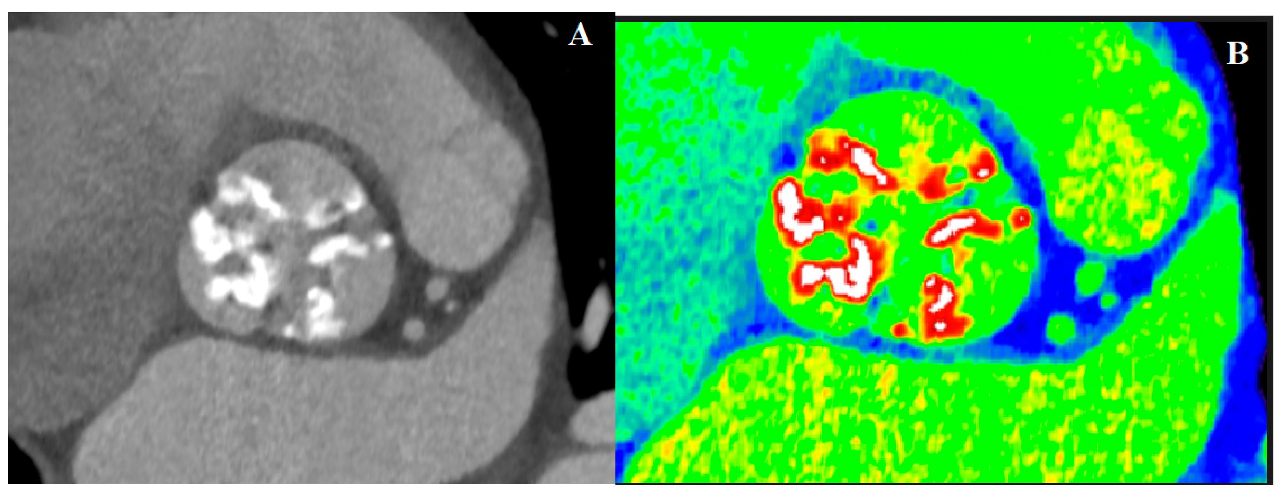 Jcm 10 03745 g004 Jcm 10 03745 g004