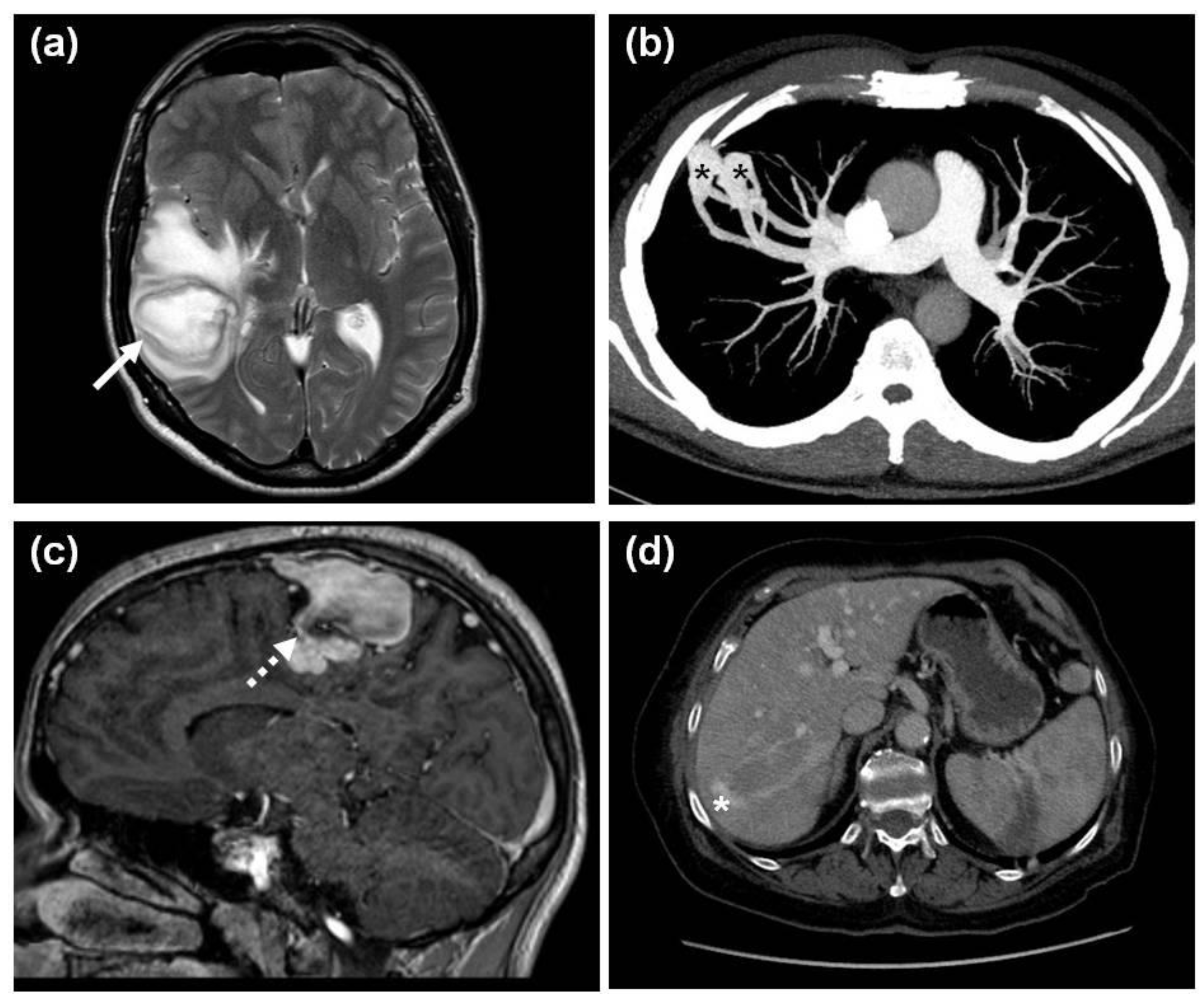 Jcm 10 03774 g005 550