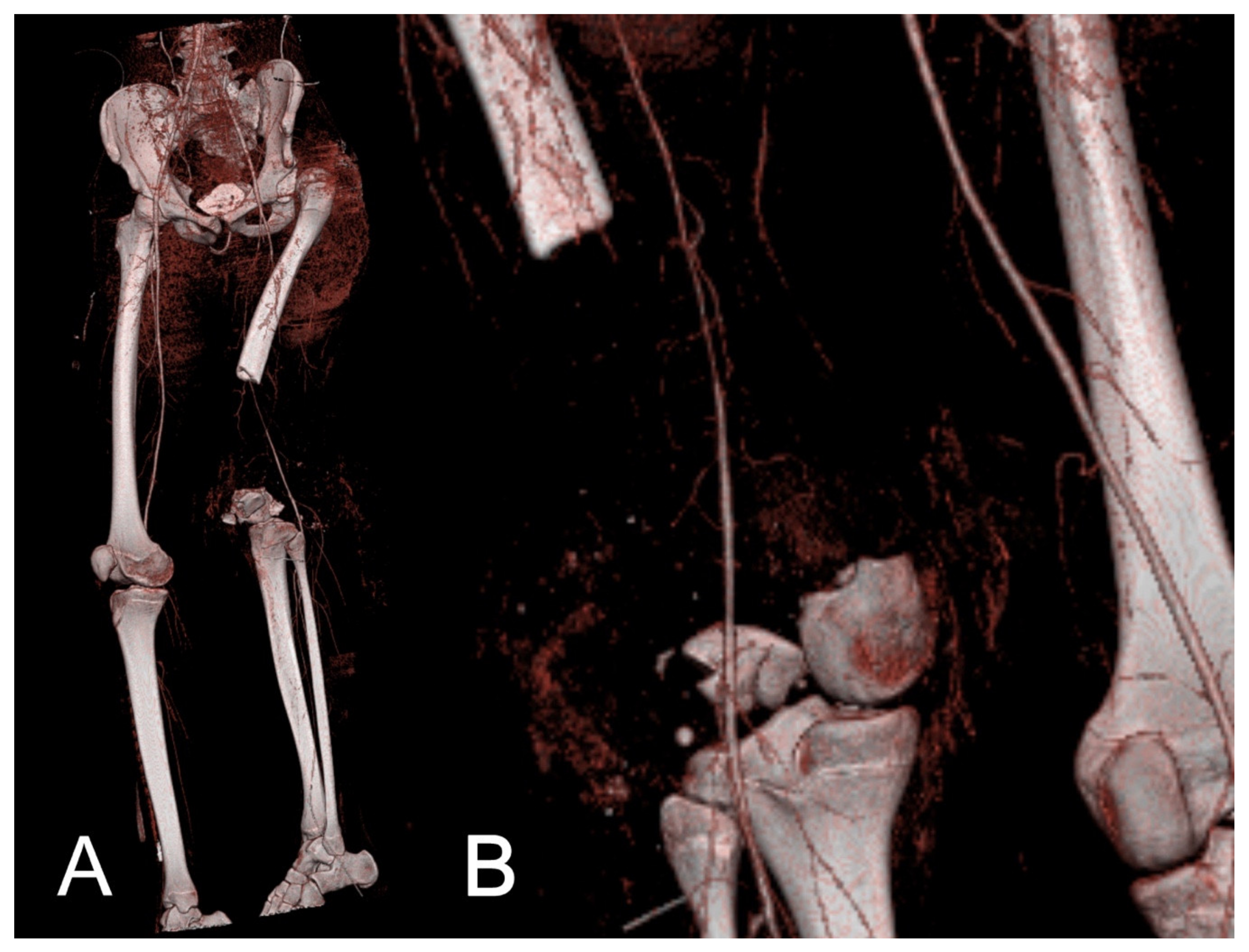 Jcm 10 03781 g001 Jcm 10 03781 g001