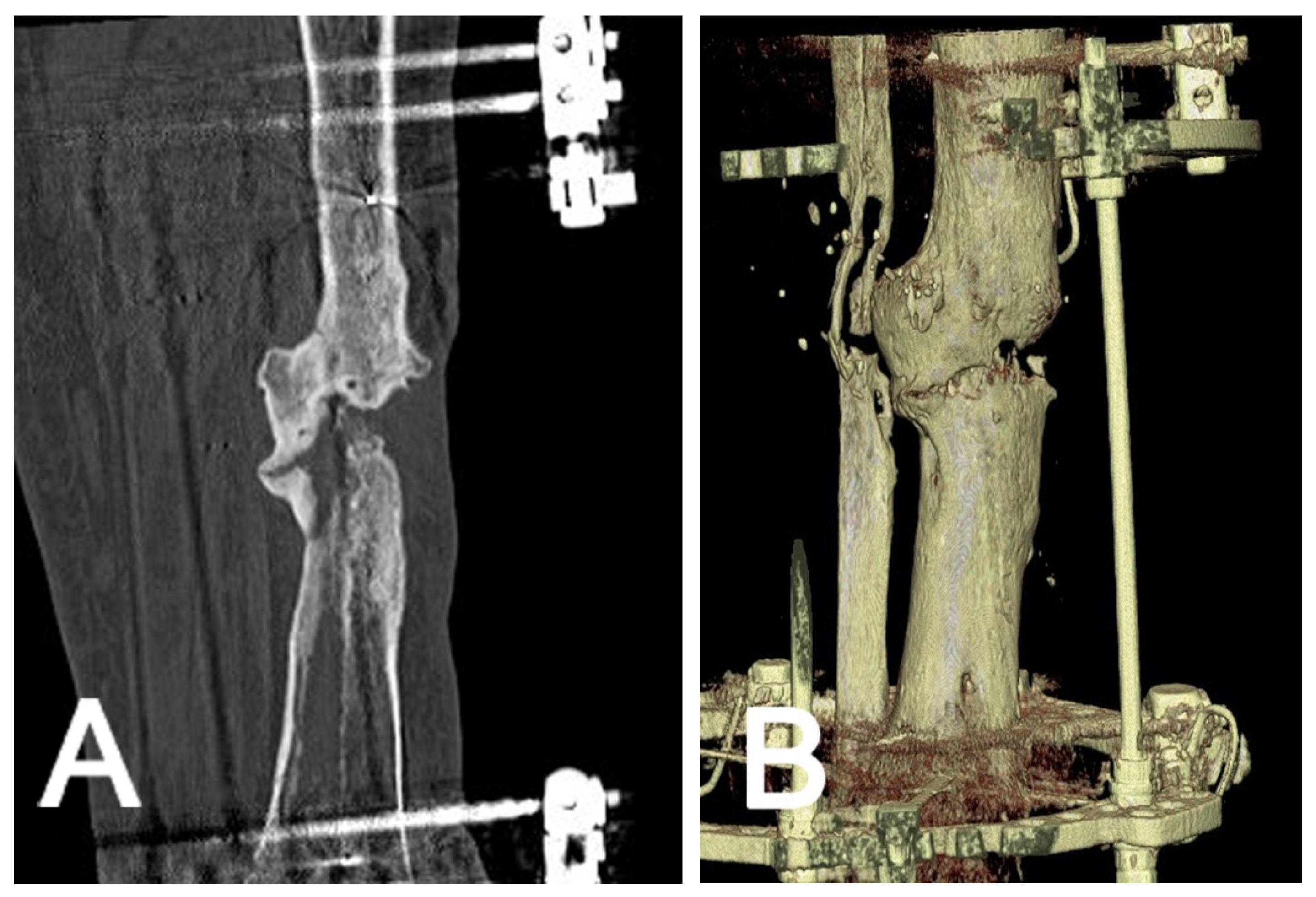 Jcm 10 03781 g002 Jcm 10 03781 g002