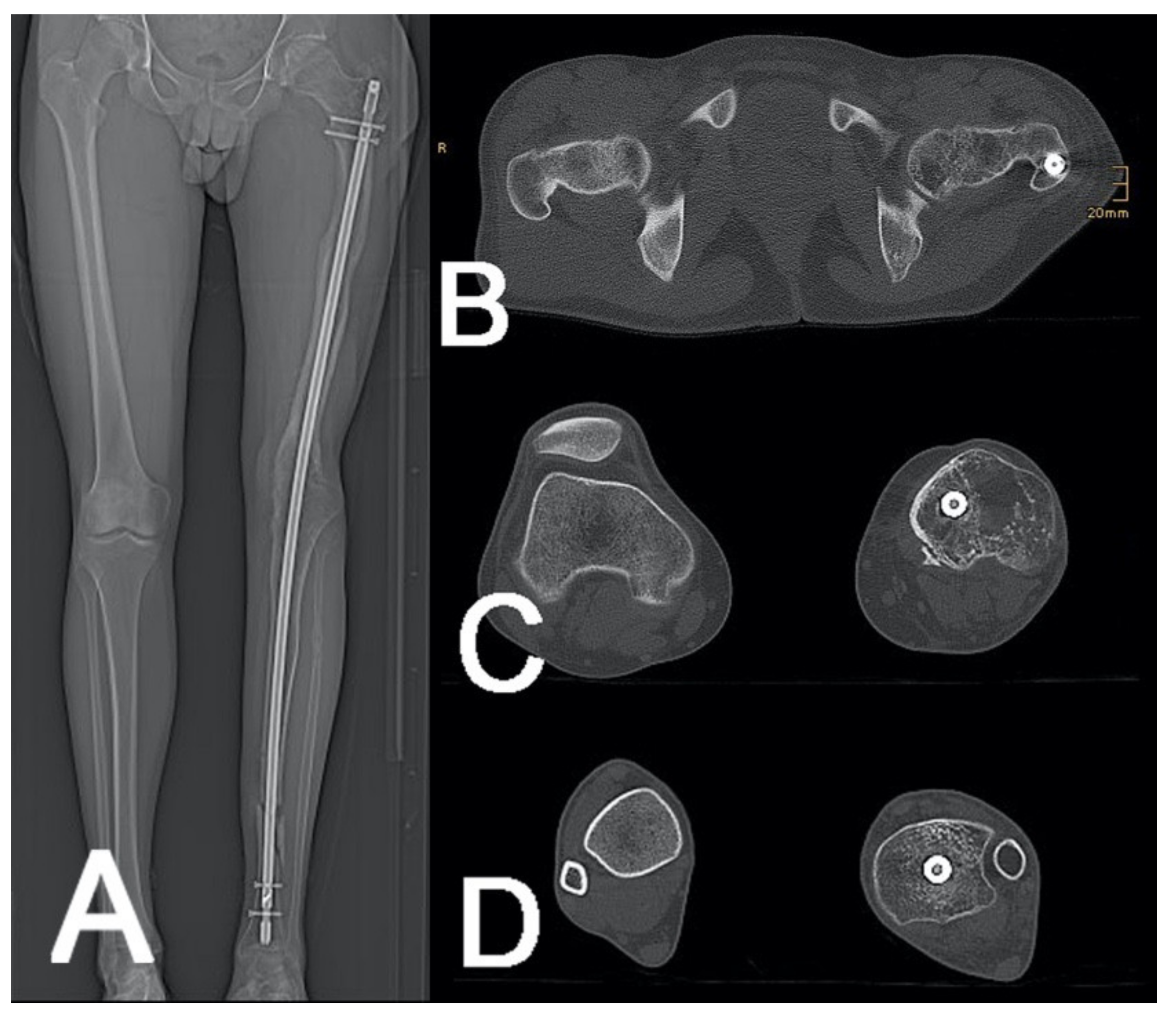 Jcm 10 03781 g006 Jcm 10 03781 g006