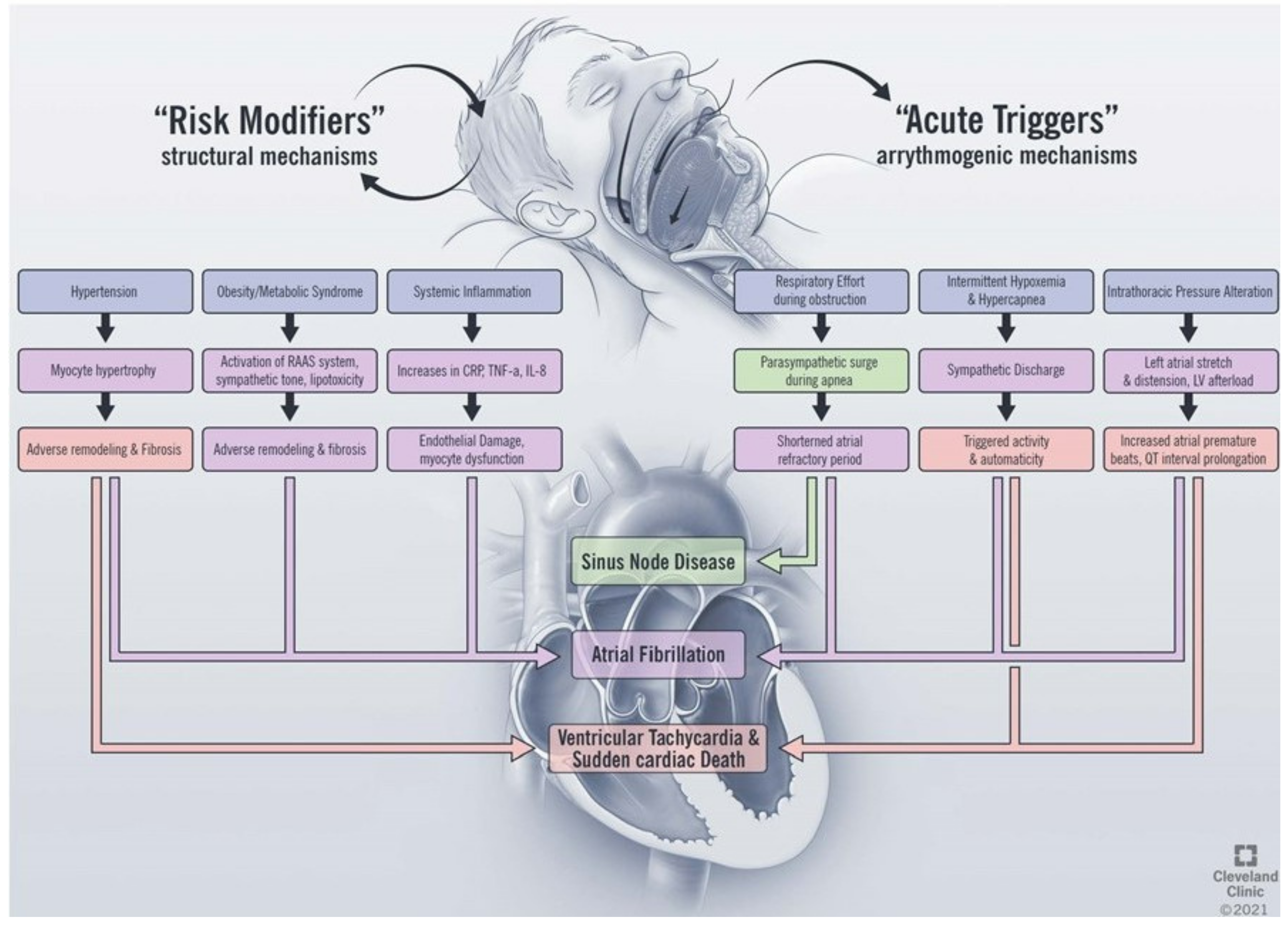 Jcm | Free Full-Text | Obstructive Sleep Apnea And Cardiac Arrhythmias: A  Contemporary Review | Html