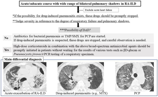 みなと Non-coding RNAs in diabetic peripheral neuropathy: their