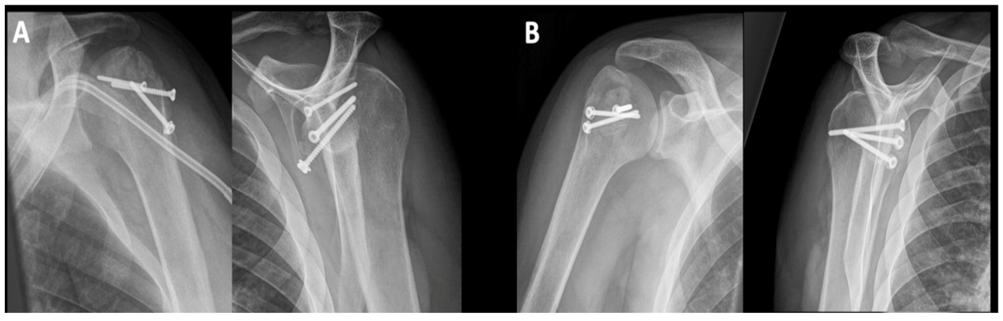 Jcm 10 03841 g003 Jcm 10 03841 g003