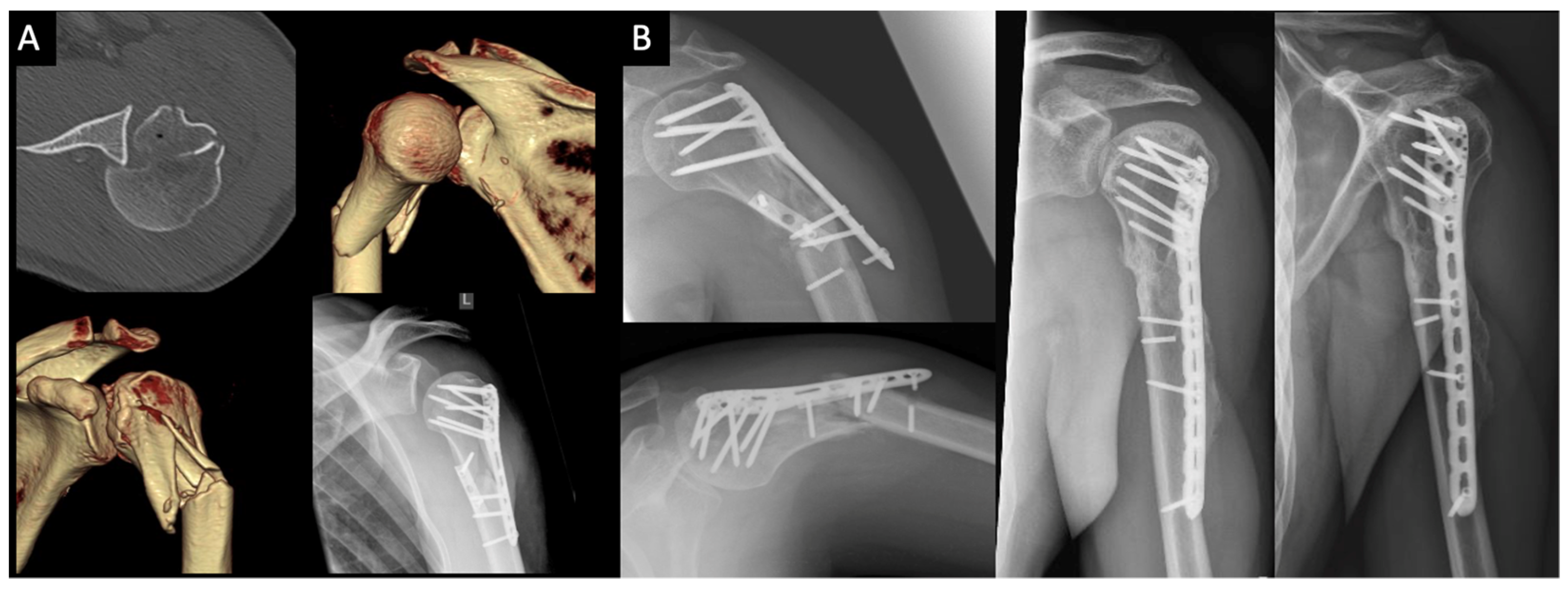 Jcm 10 03841 g004 Jcm 10 03841 g004