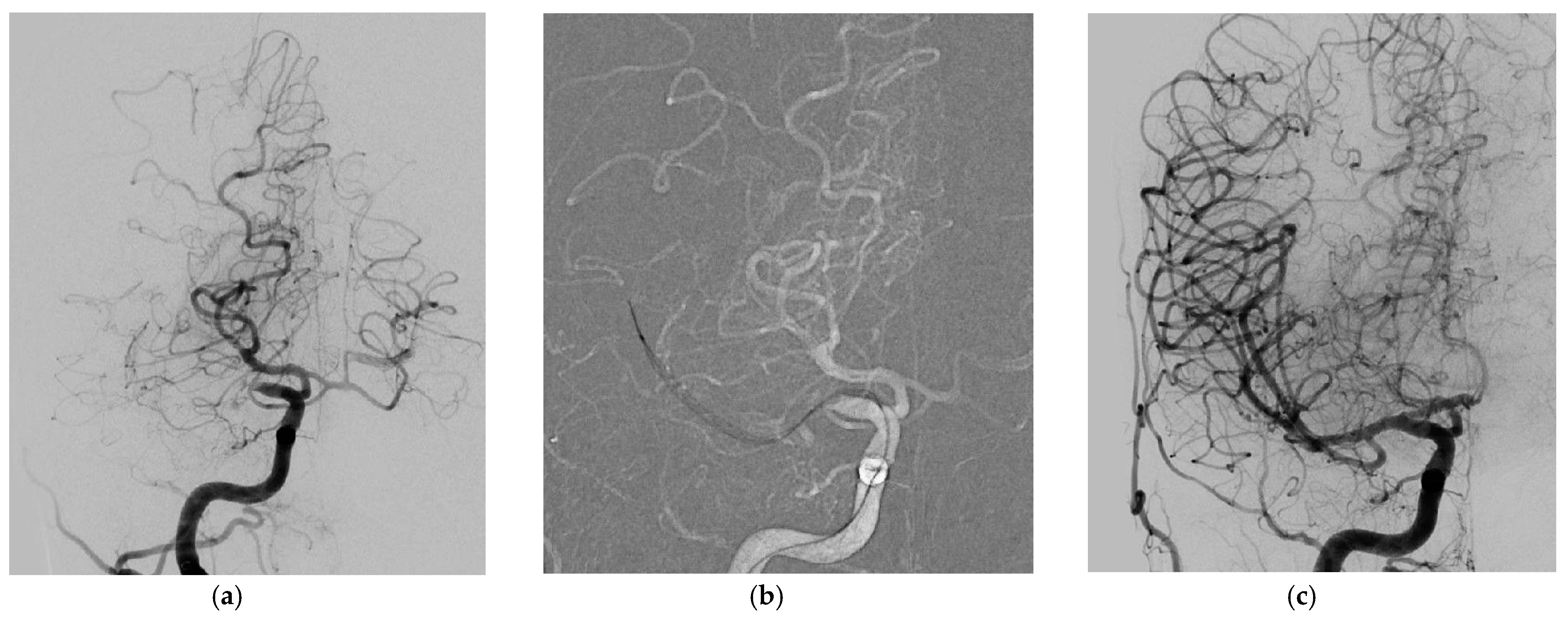 Jcm 10 03853 g002 550