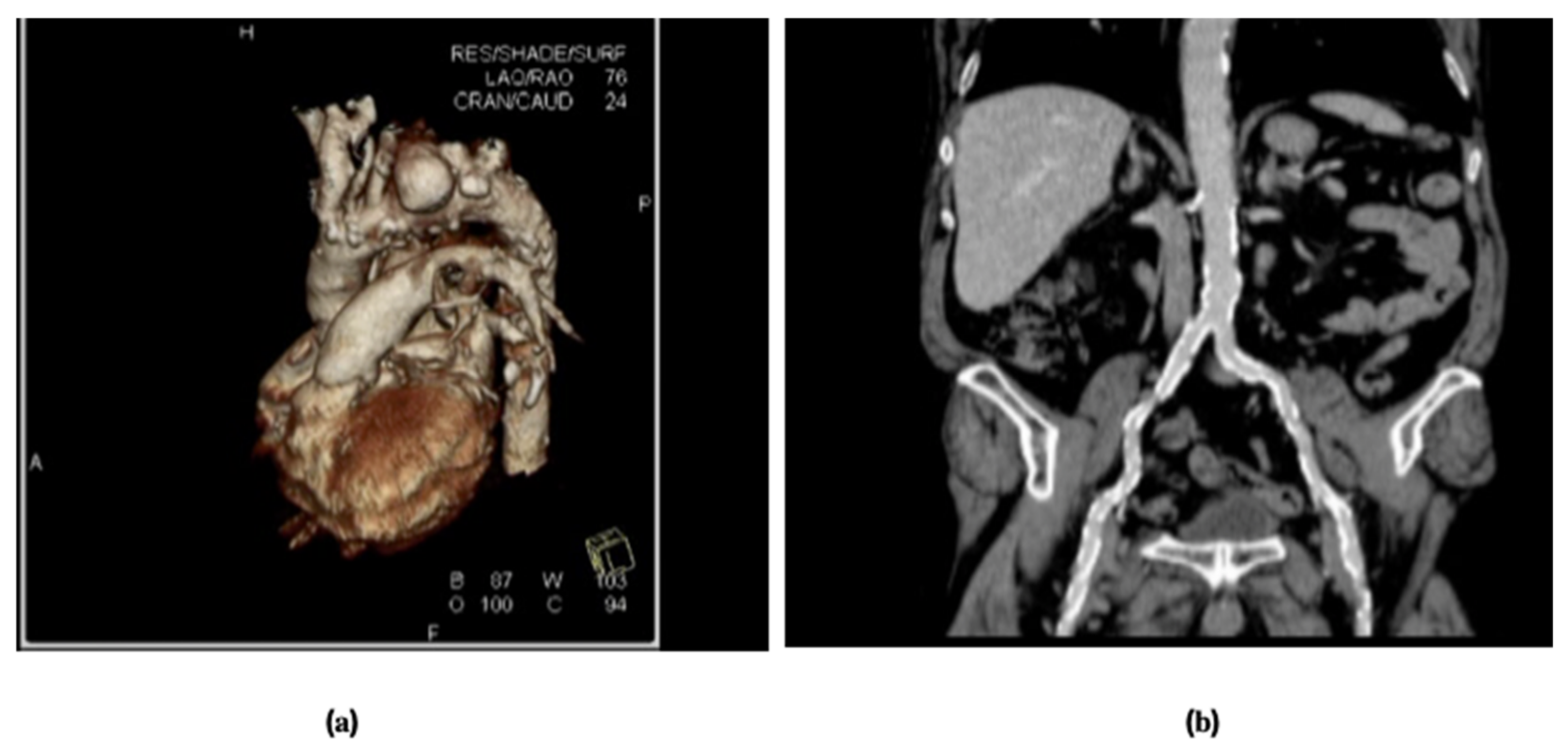 Jcm 10 03857 g003 Jcm 10 03857 g003