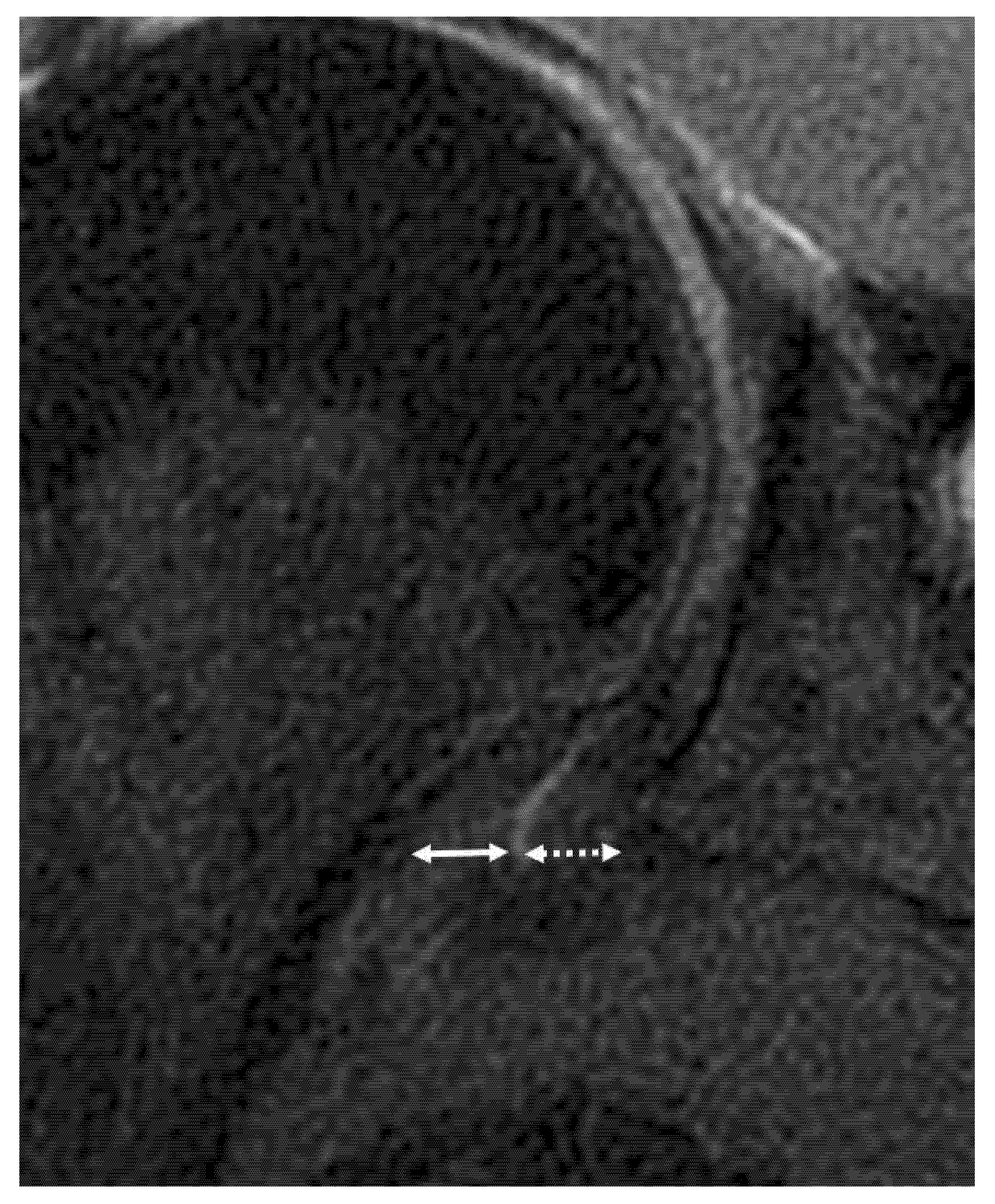 JCM Free FullText MR Imaging Biomarkers for Clinical Impairment