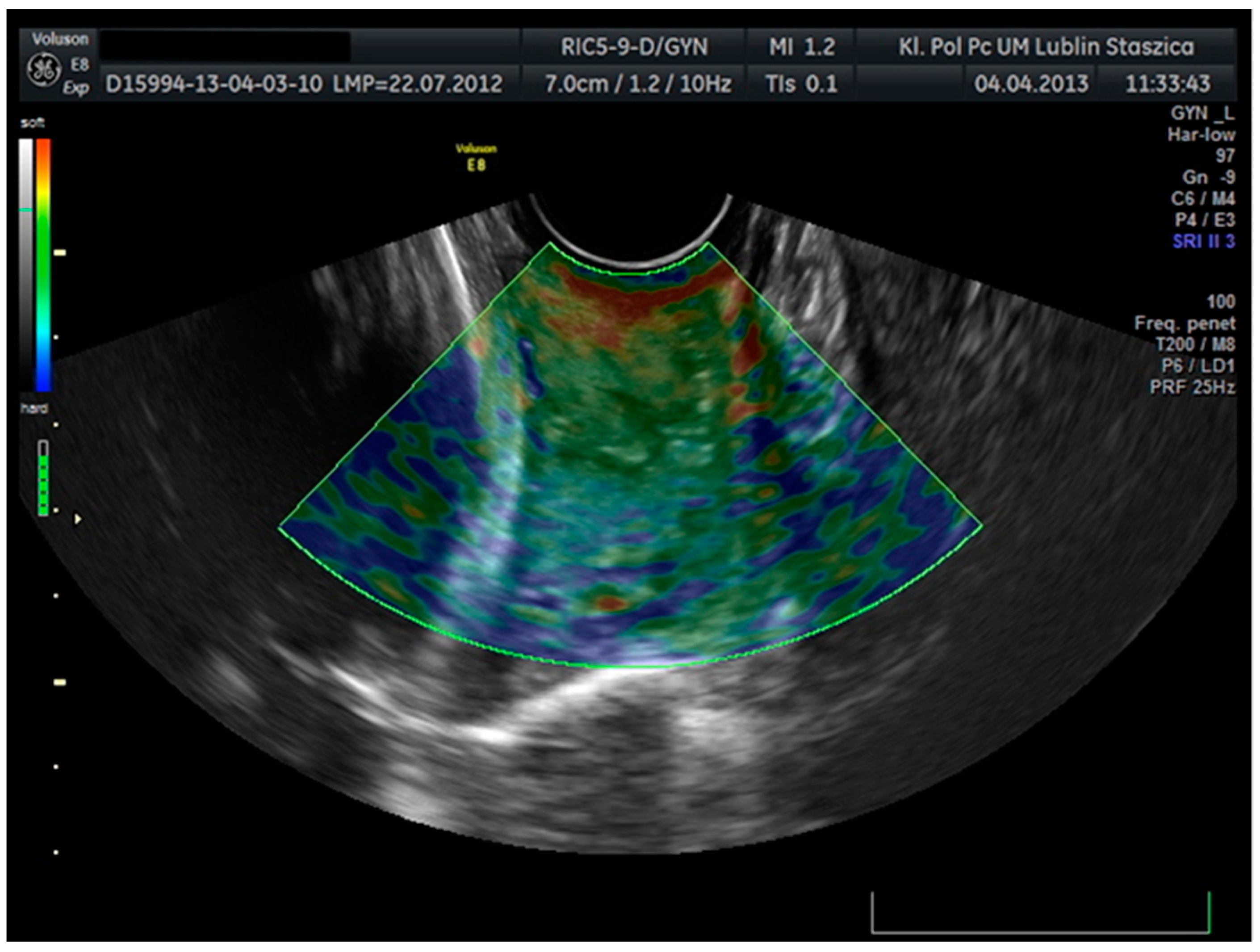 Jcm 10 03886 g002 550