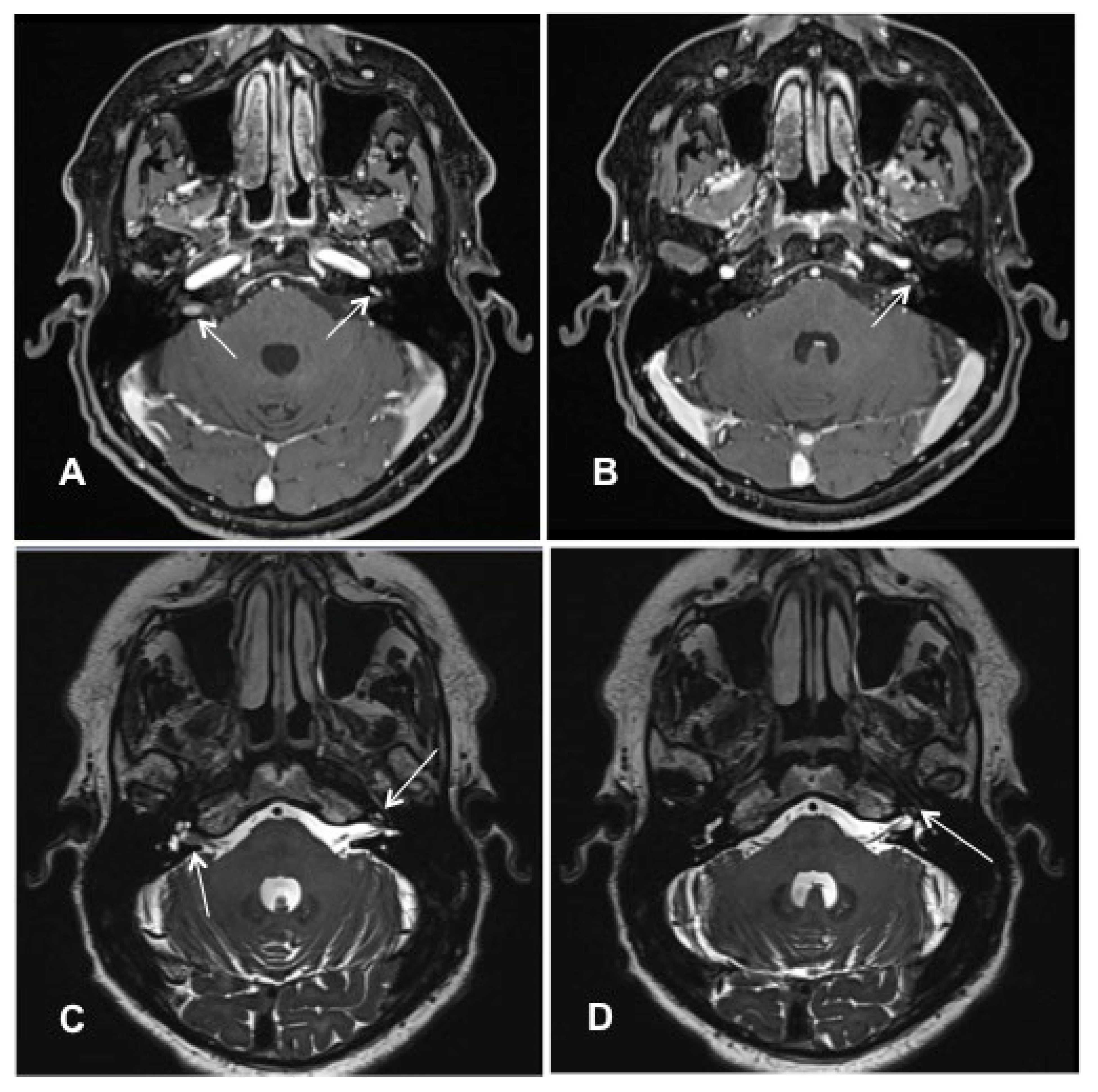 Jcm 10 03899 g004 550