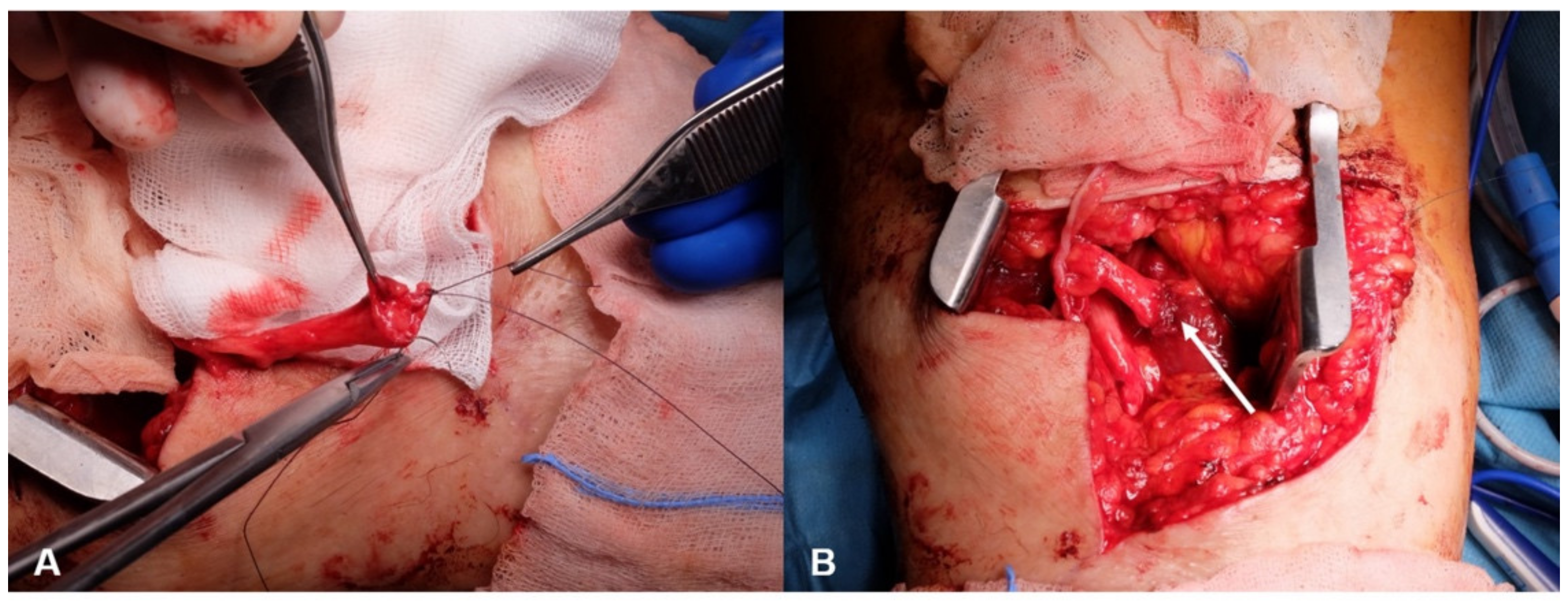 What To Do When Experiencing Nerve Pain After Surgery - APC