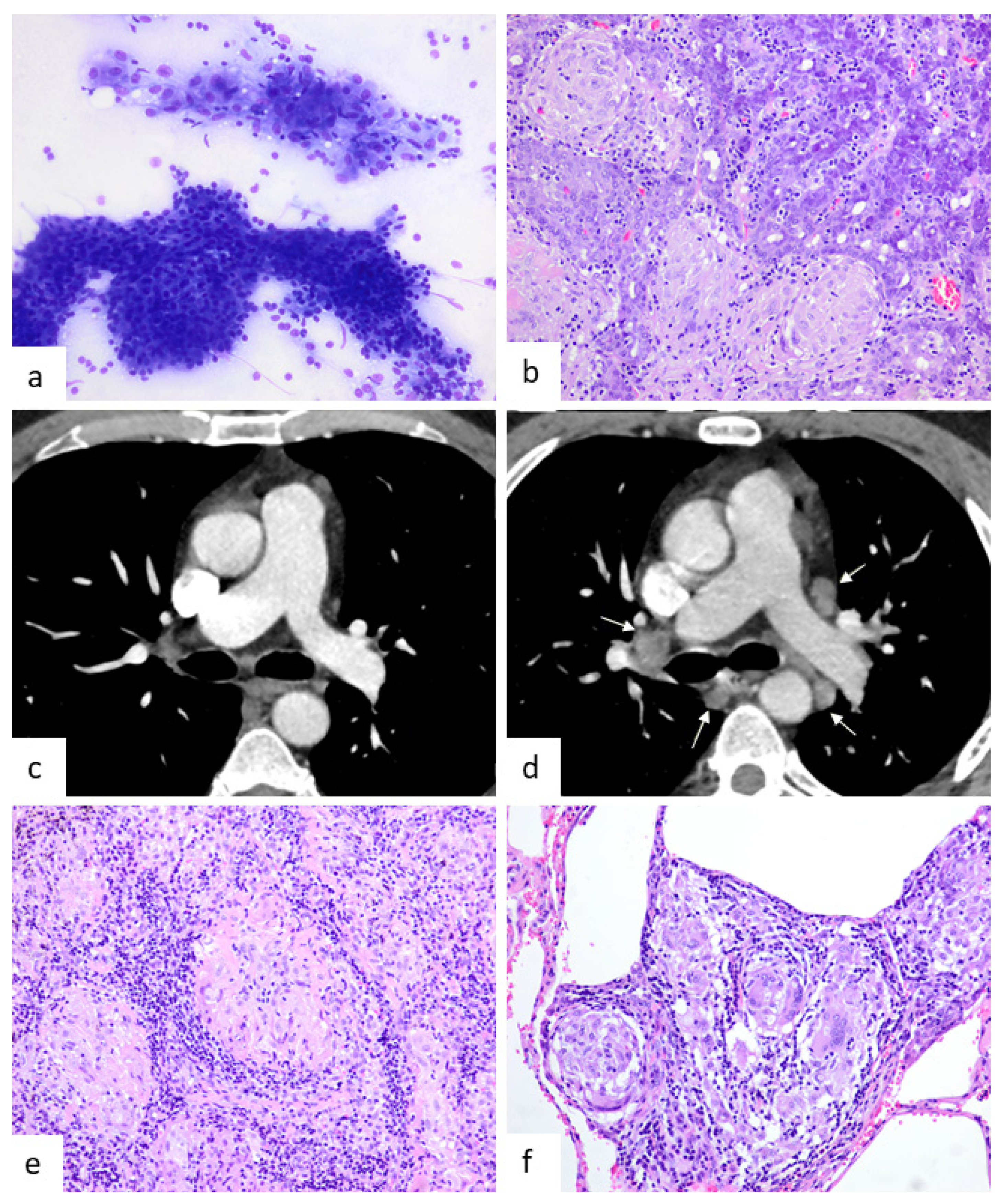Jcm 10 04151 g002 550
