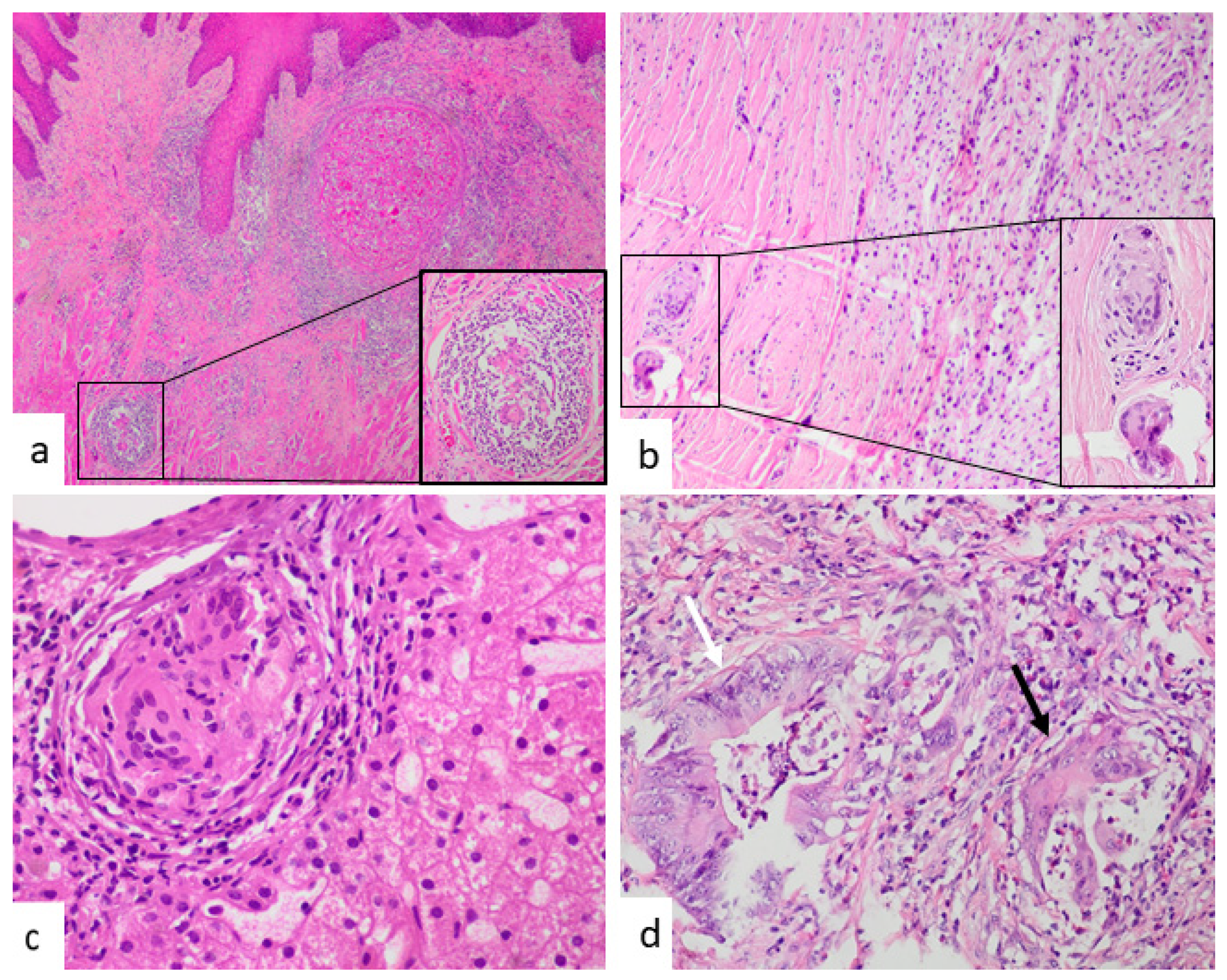 Jcm 10 04151 g004 550
