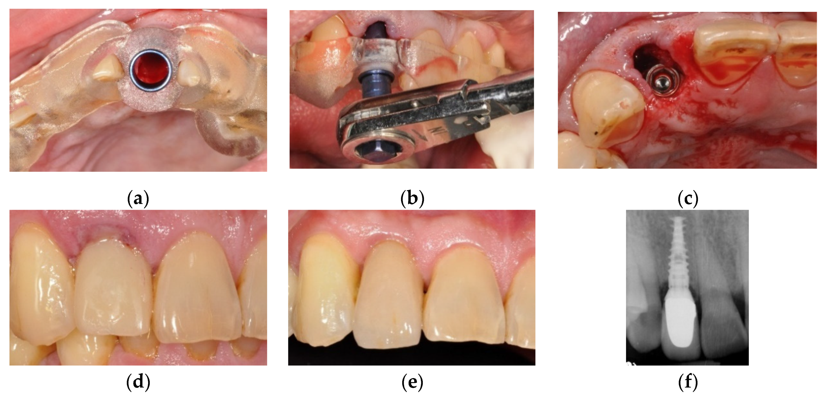 Jcm 10 04183 g003 550