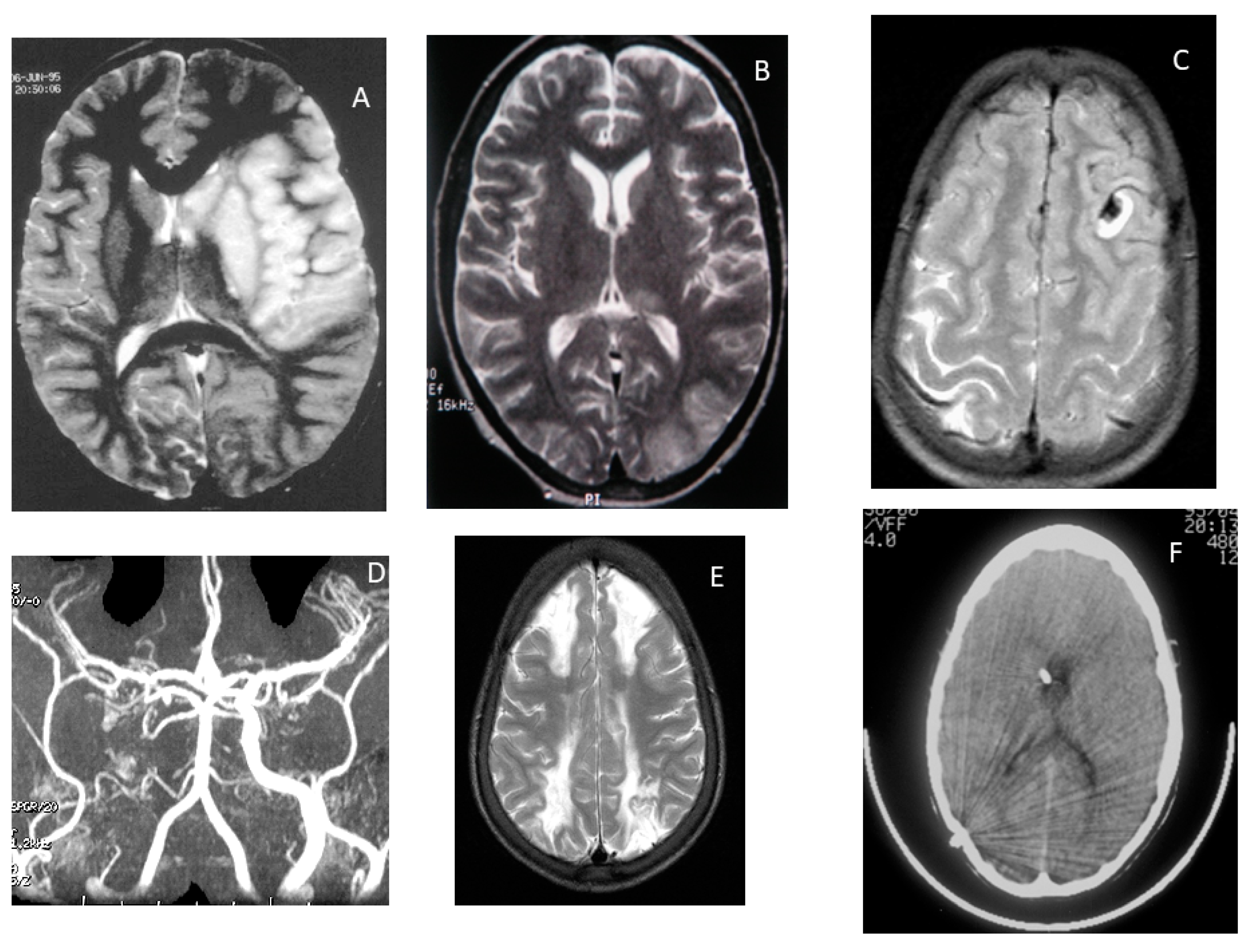 Jcm 10 04232 g003 Jcm 10 04232 g003