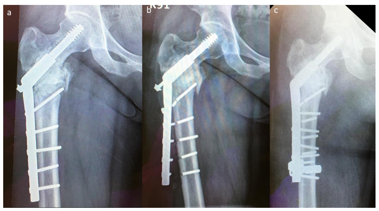 Jcm 10 04271 g004 550