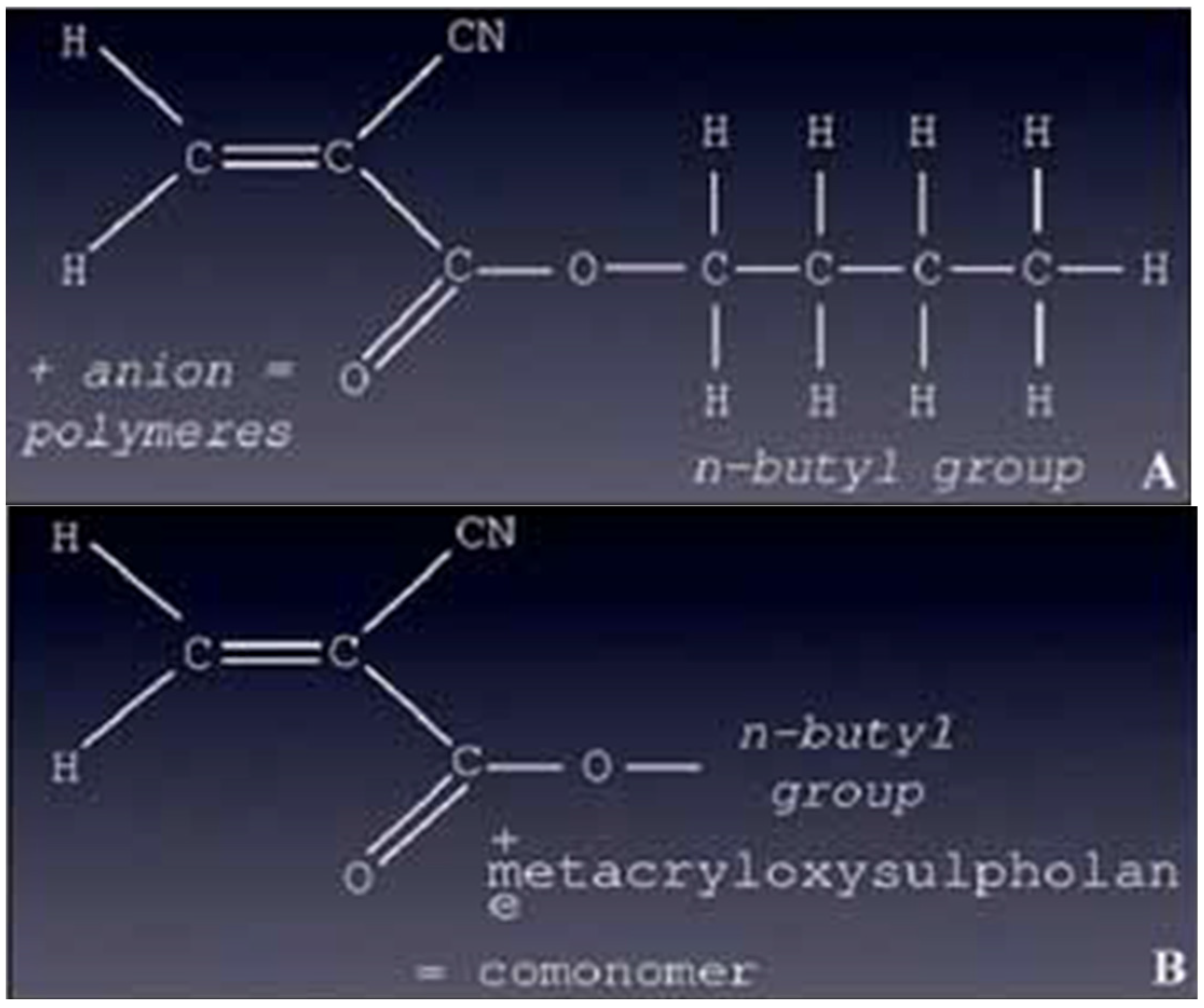 JCM Free FullText Endovascular Use of CyanoacrylateLipiodol