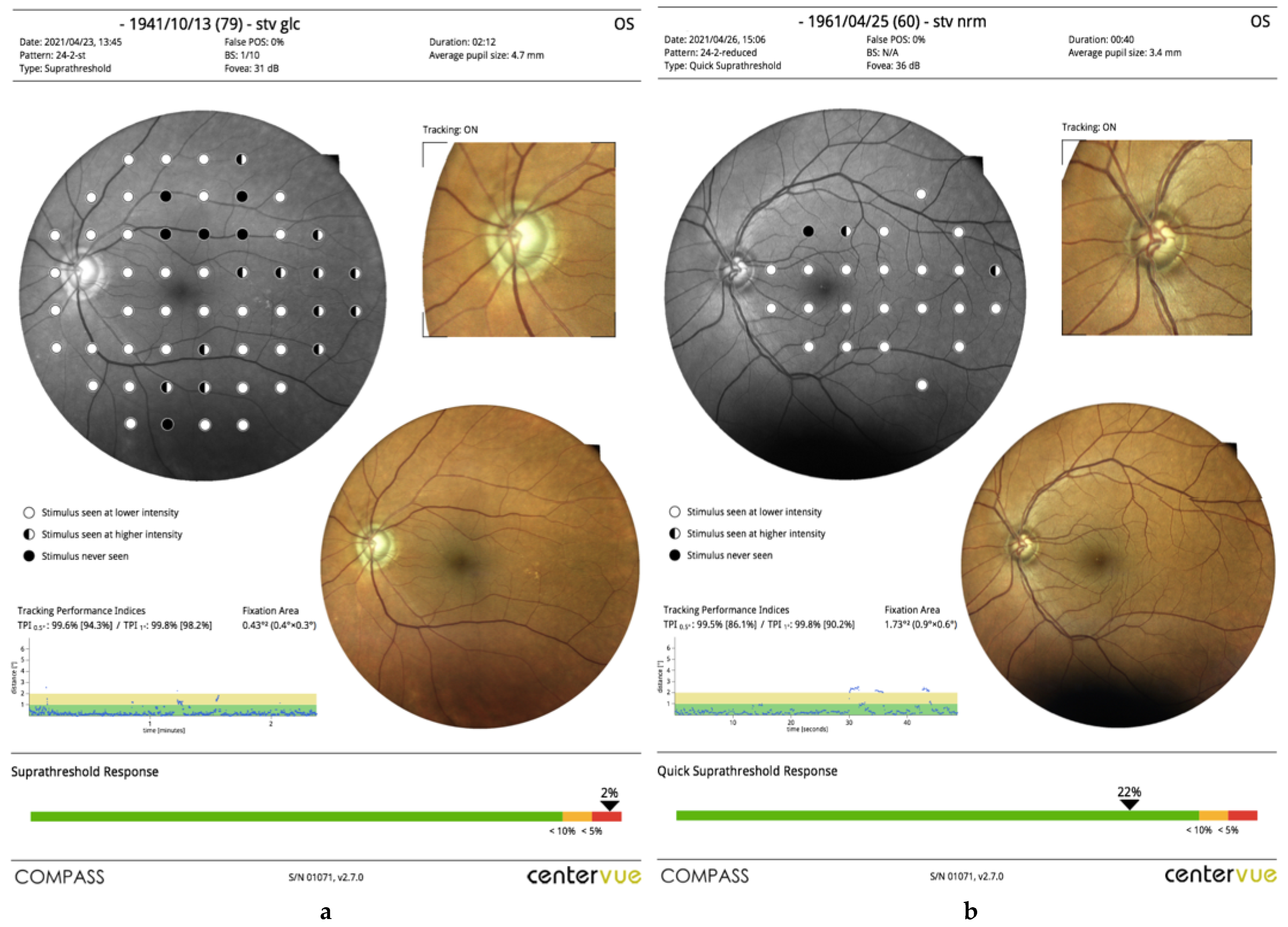 TEXT眼科学 = OPHTHALMOLOGY 61FTF2nvVZL.jpg
