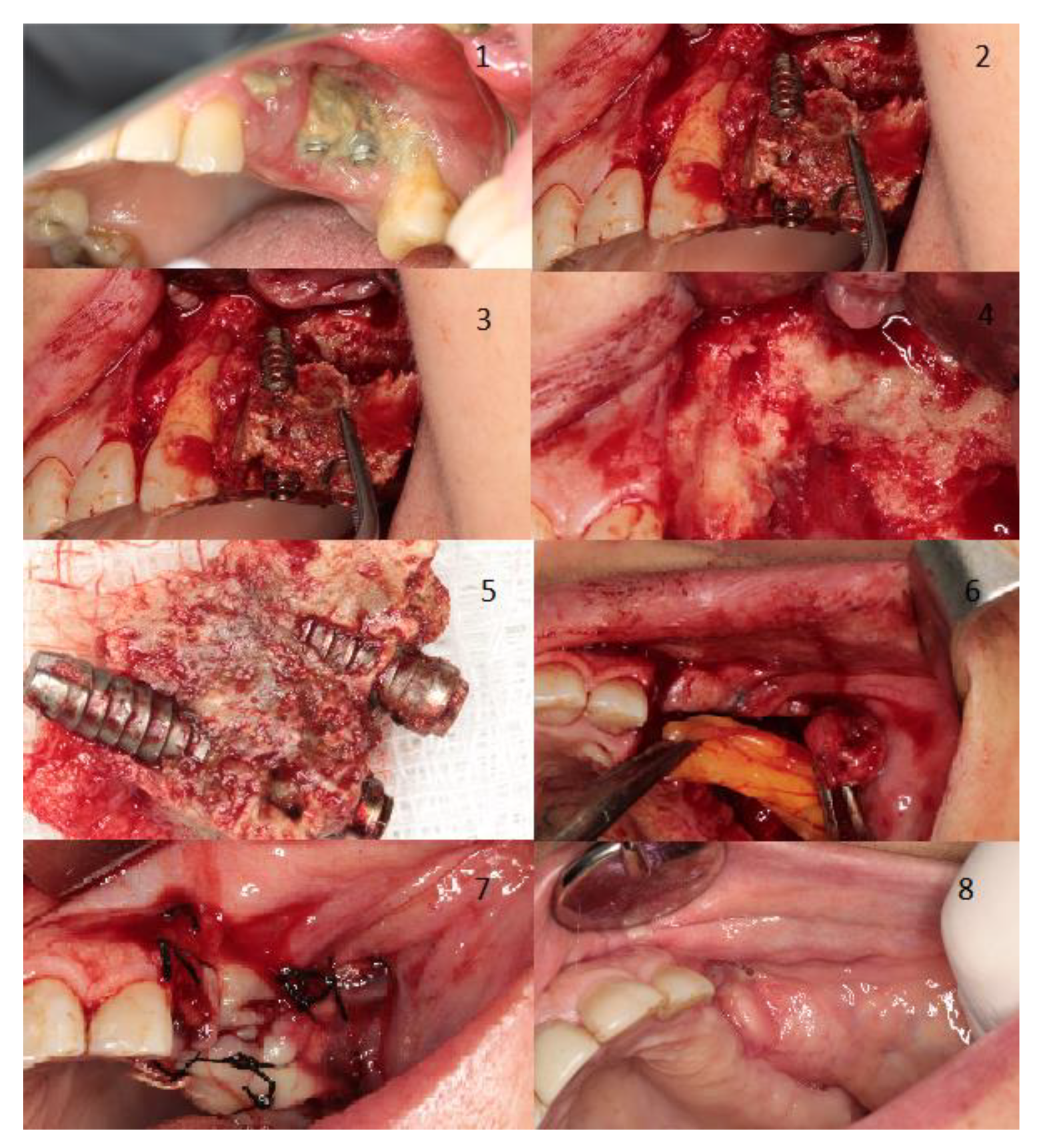 Jcm 10 04367 g003 550