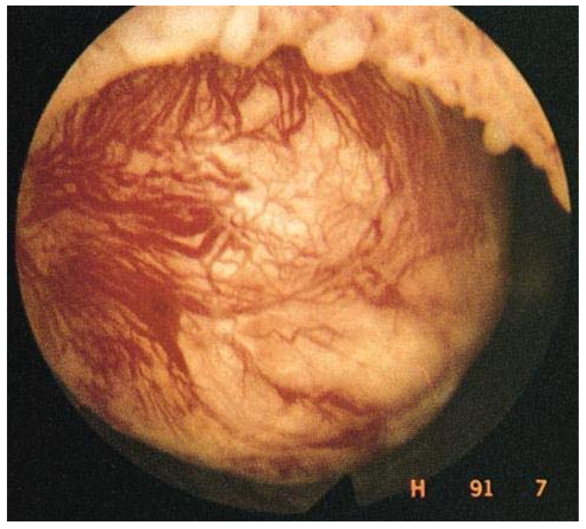 Jcm 10 04389 g003 550