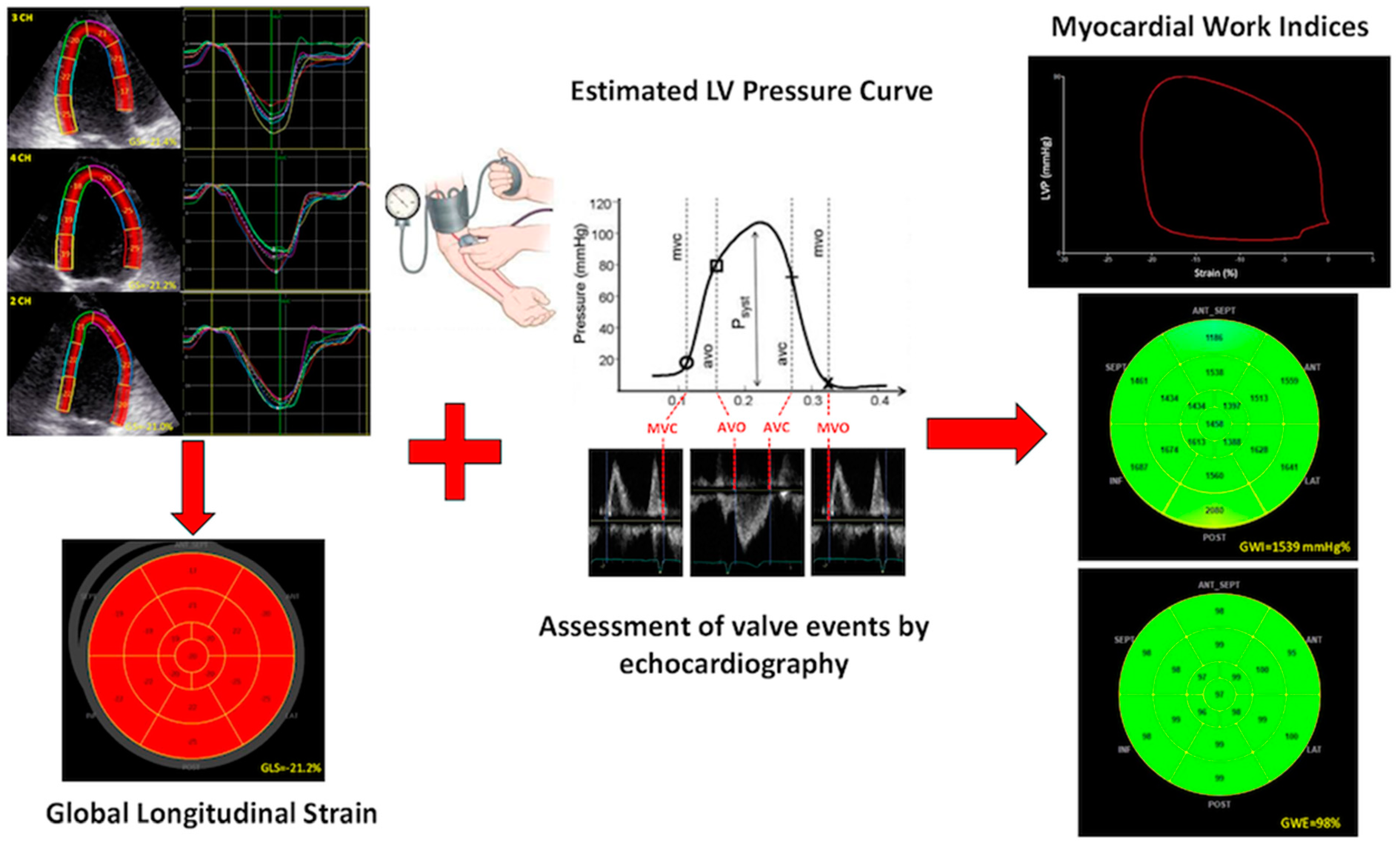 Global longitudinal strain: Bull's Eye Map. Global longitudinal strains