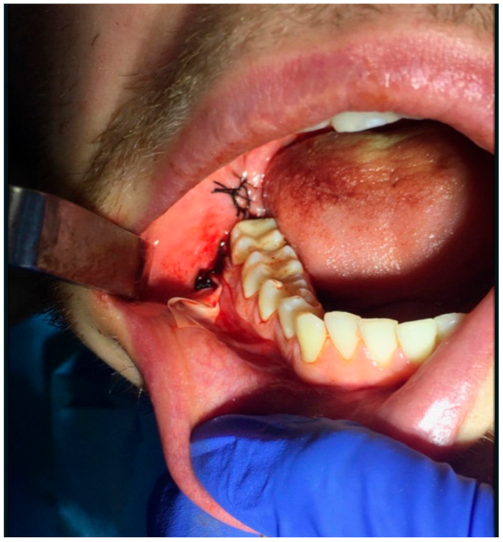 Jcm 10 04705 g002 Jcm 10 04705 g002